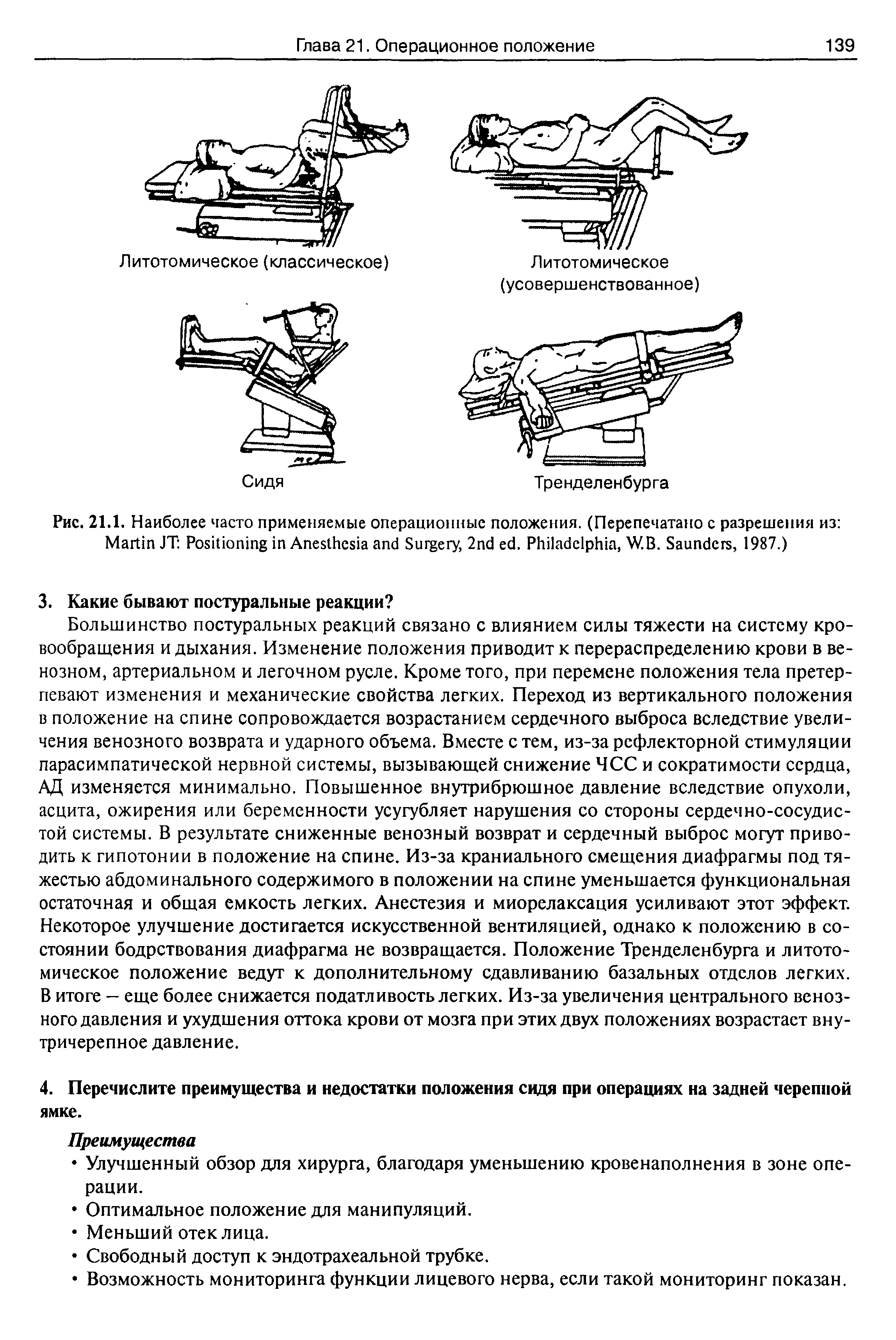Рис. 21.1. Наиболее часто применяемые операционные положения. (Перепечатано с разрешения из M JT P A S , 2 . P , W.B. S , 1987.)...