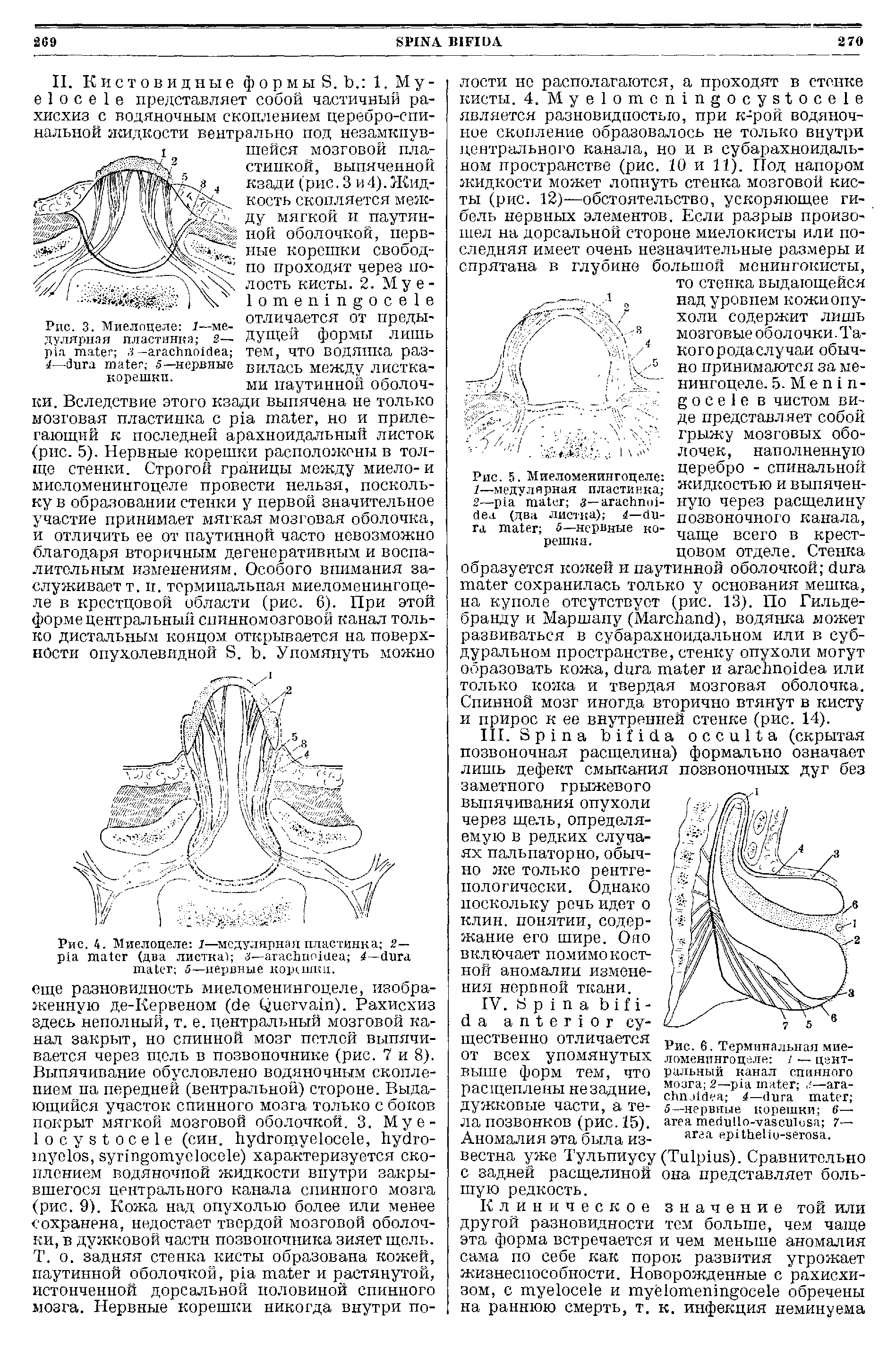 Рис. 5. Миеломенингоцеле 7—модулярная пластинка 2— < — - (два листка) — 5—нервные корешки.