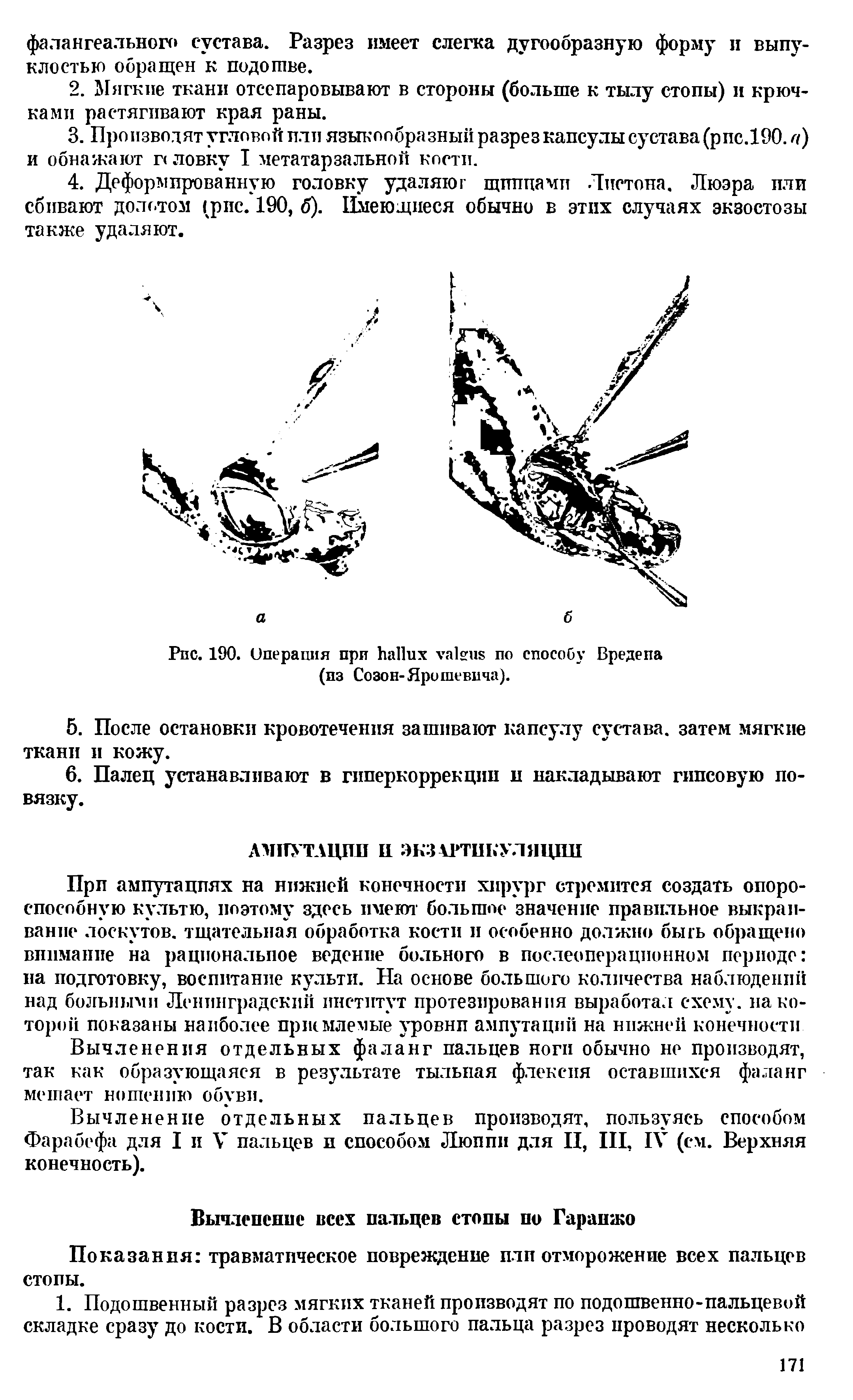 Рис. 190. Операция при по способу Вредепа (из Созон-Яро шевича).