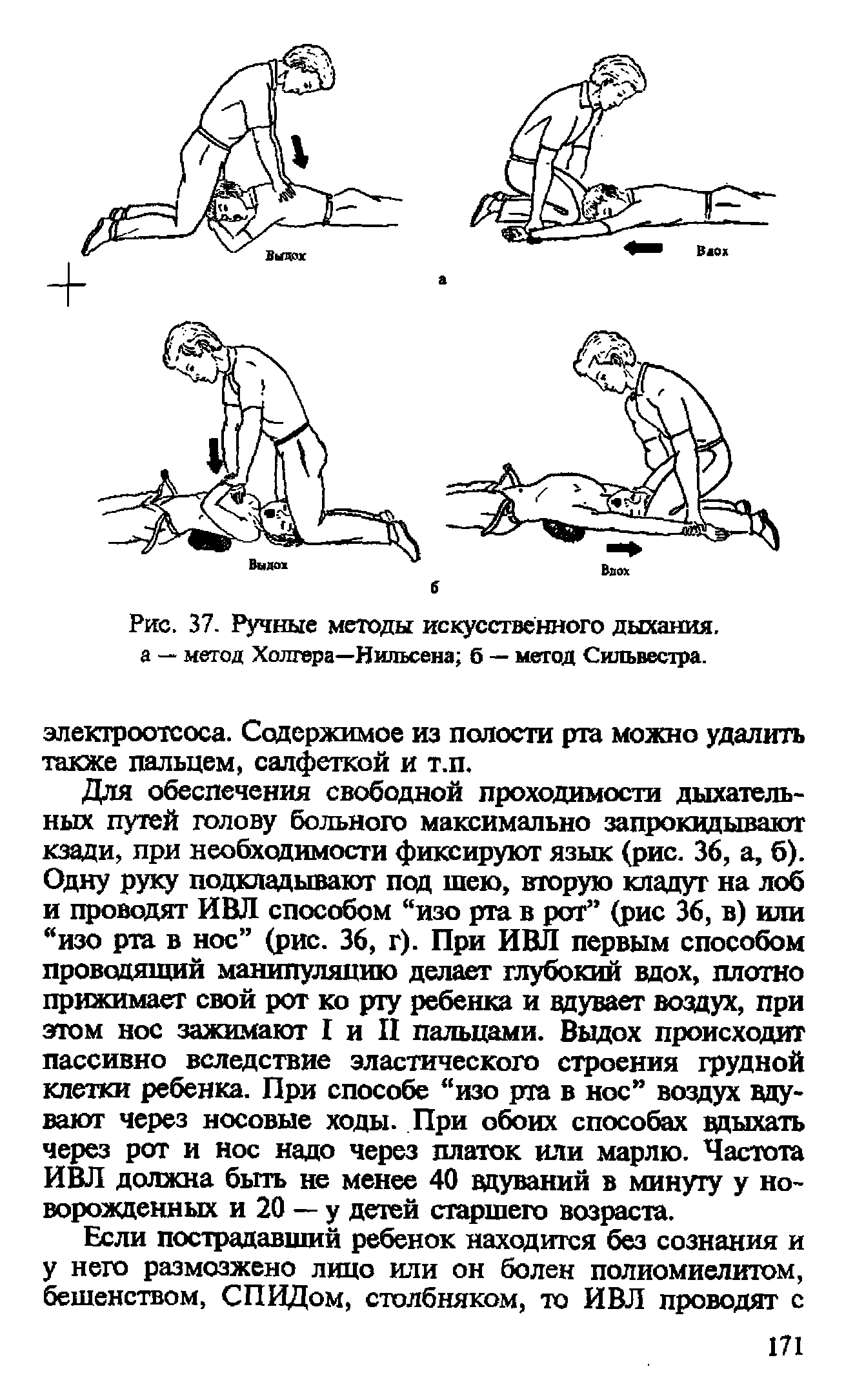 Рис. 37. Ручные методы искусственного дыхания, а — метод Холтера—Нильсена б — метод Сильвестра.