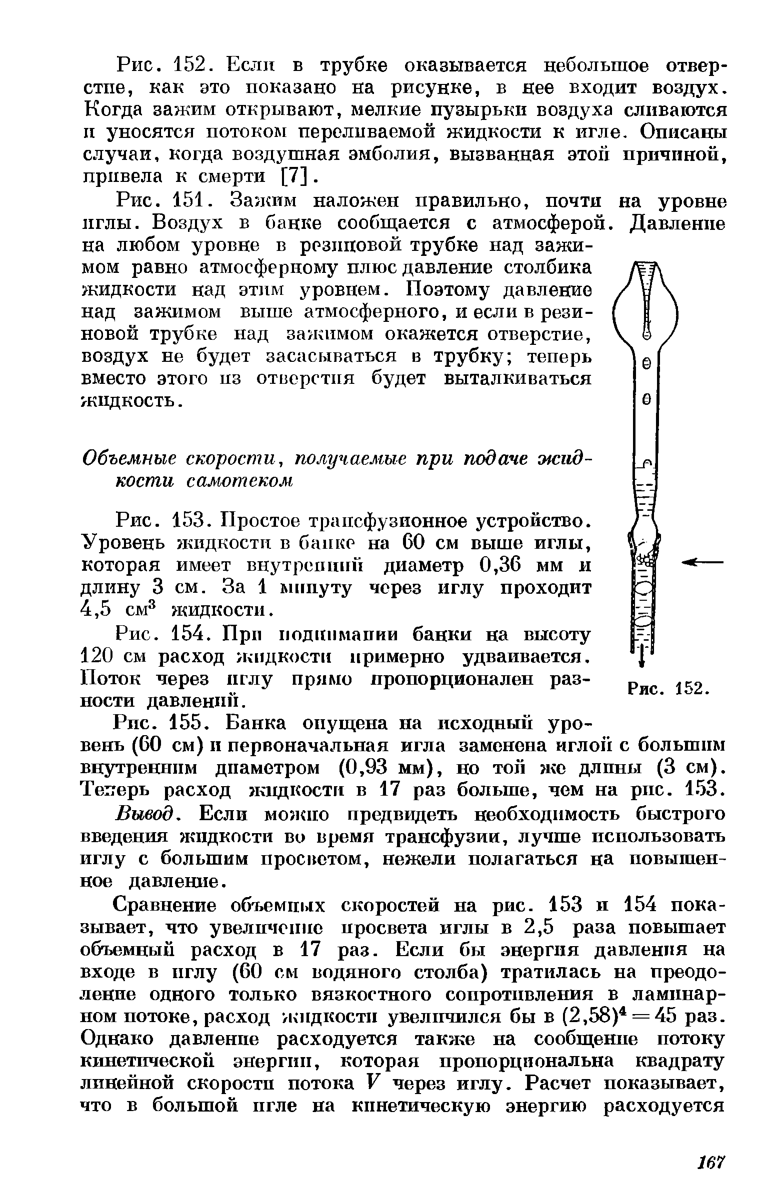 Рис. 153. Простое трансфузионное устройство. Уровень жидкости в банке на 60 см выше иглы, которая имеет внутренний диаметр 0,36 мм и длину 3 см. За 1 мппуту через иглу проходит 4,5 см3 жидкости.