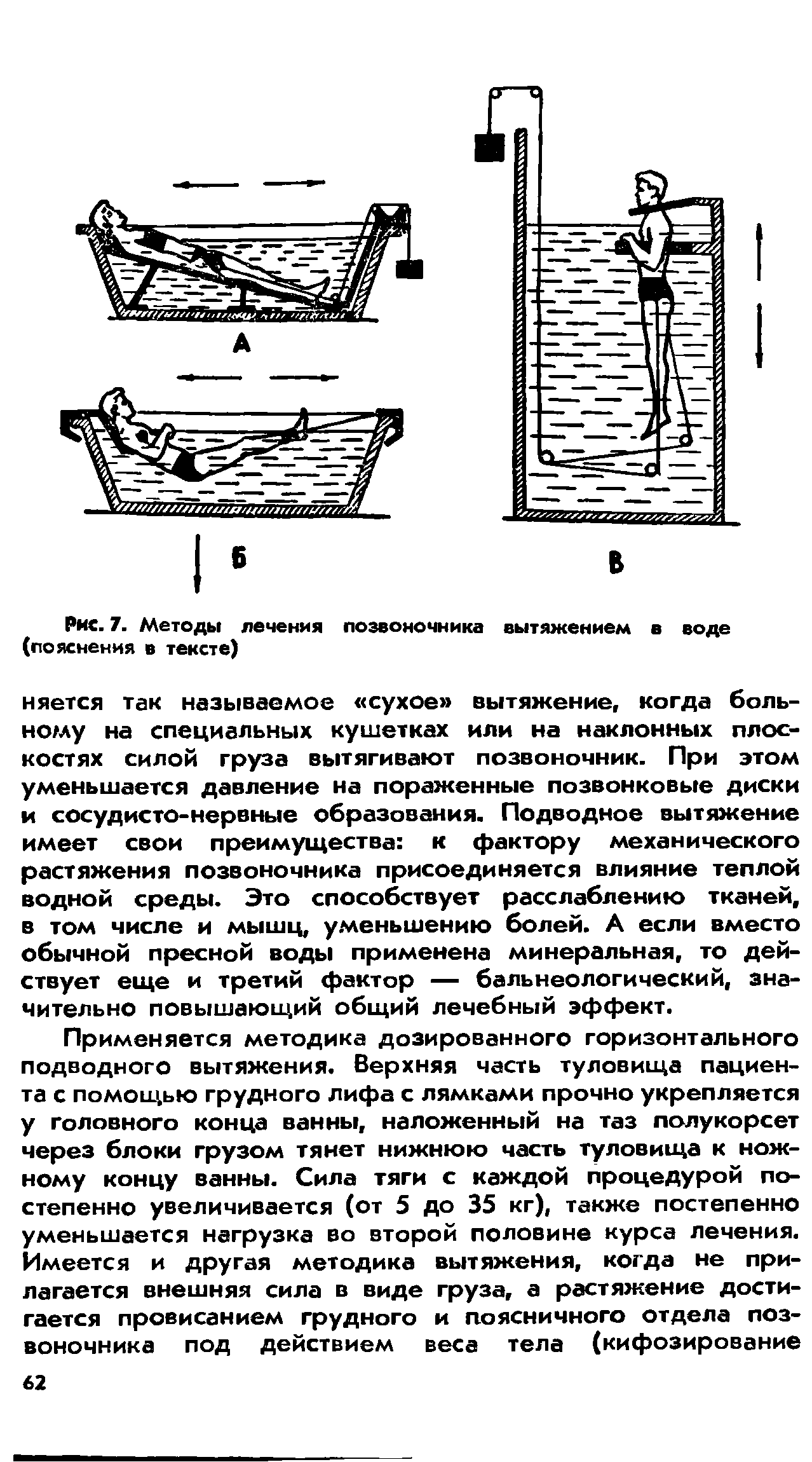 Рис. 7. Методы лечения позвоночника вытяжением в воде (пояснения в тексте)...