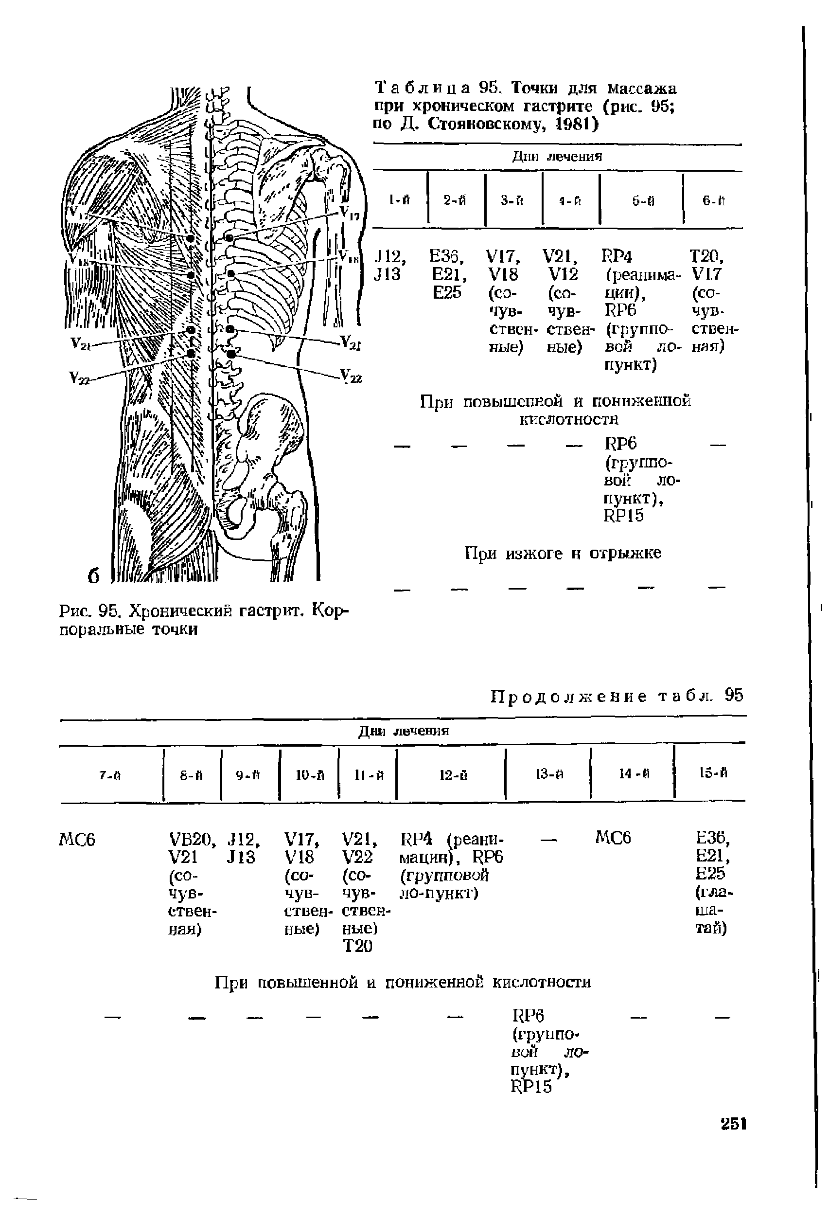 Таблица 95. Точки для массажа при хроническом гастрите (рис. 95 по Д. Стояновскому, 981)...