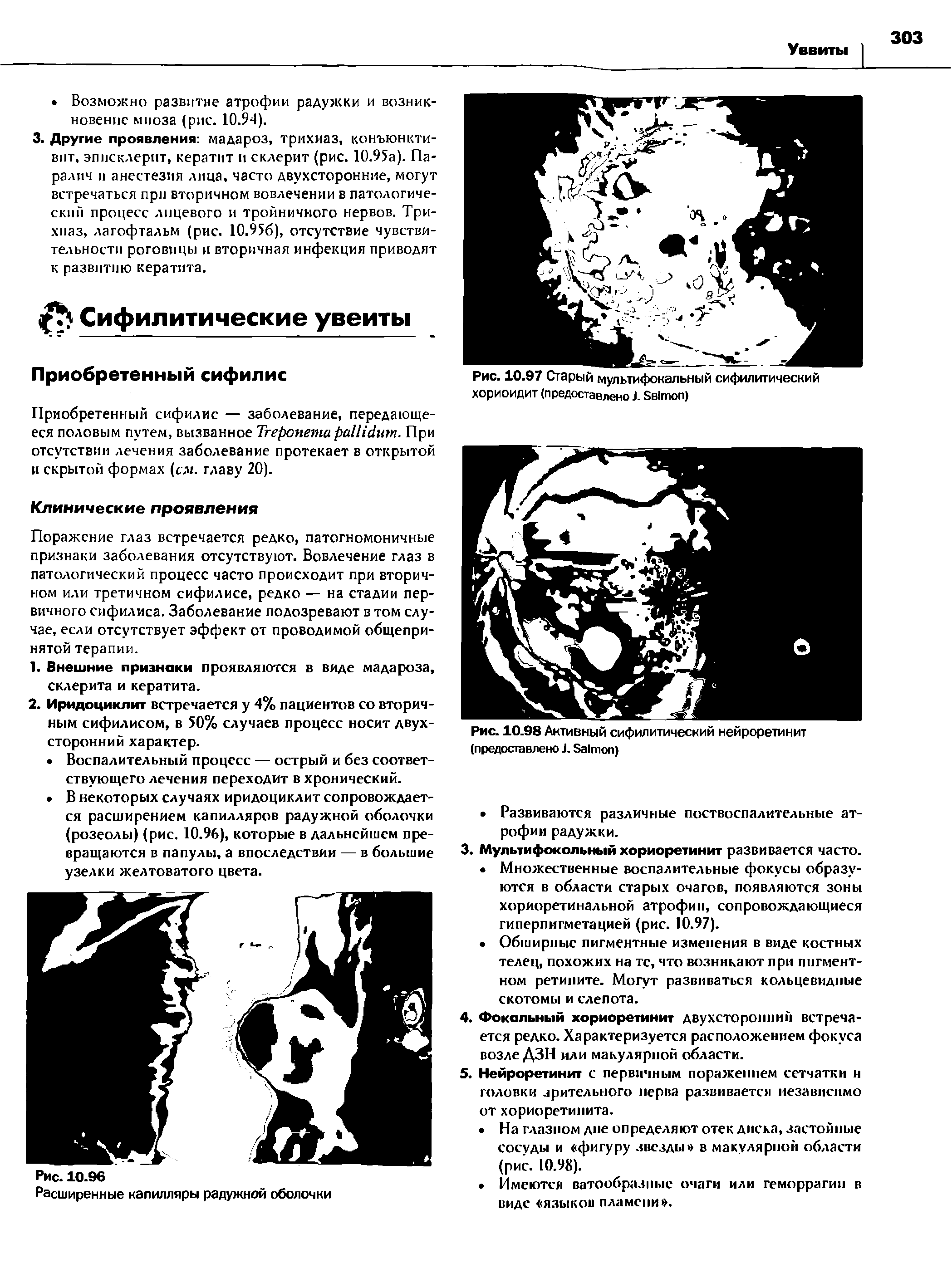 Рис. 10.97 Старый мультифокальный сифилитический хориоидит (предоставлено J. S )...