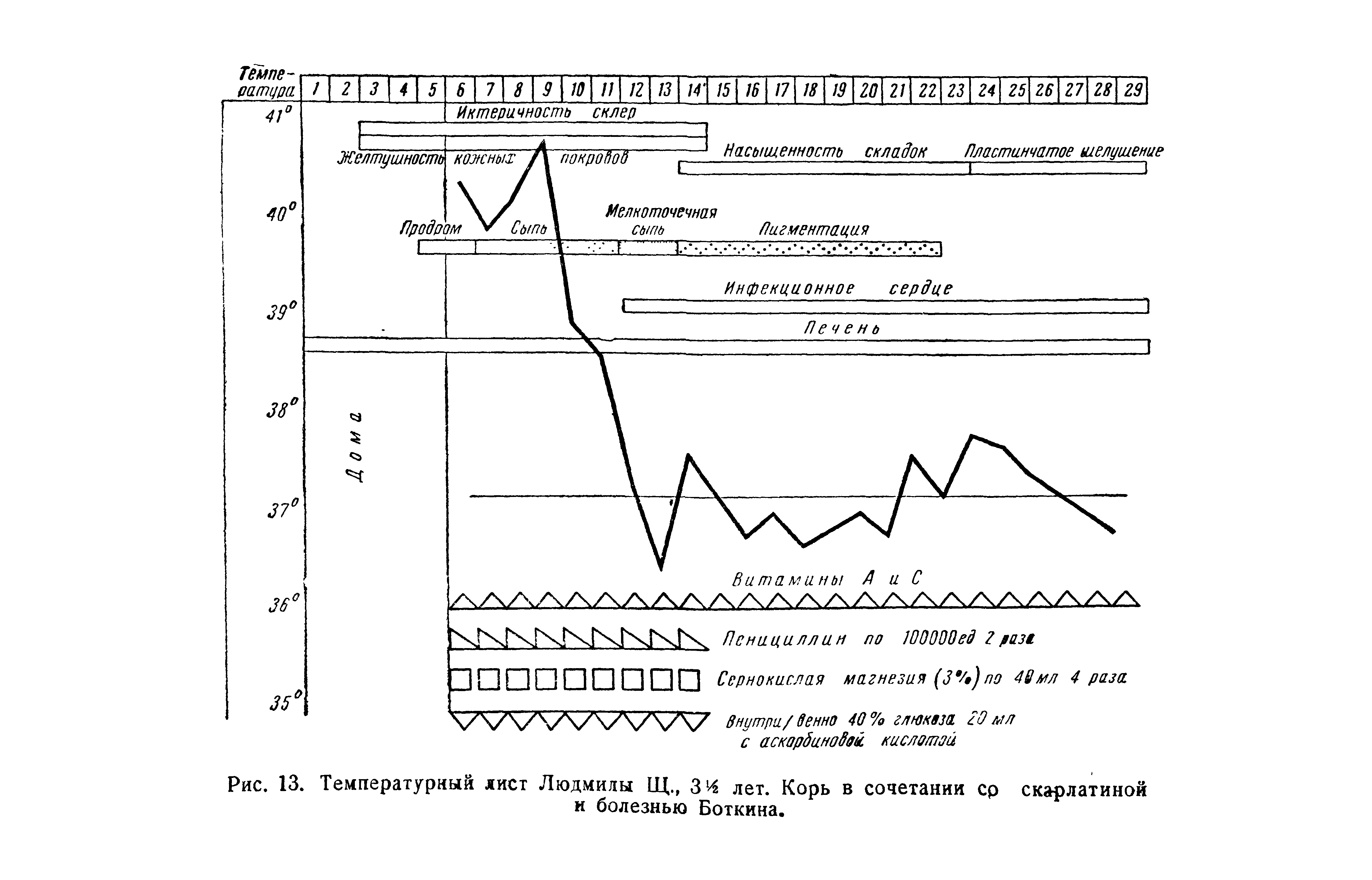 Рис. 13. Температурный лист Людмилы Щ., 3 лет. Корь в сочетании ср скарлатиной к болезнью Боткина.