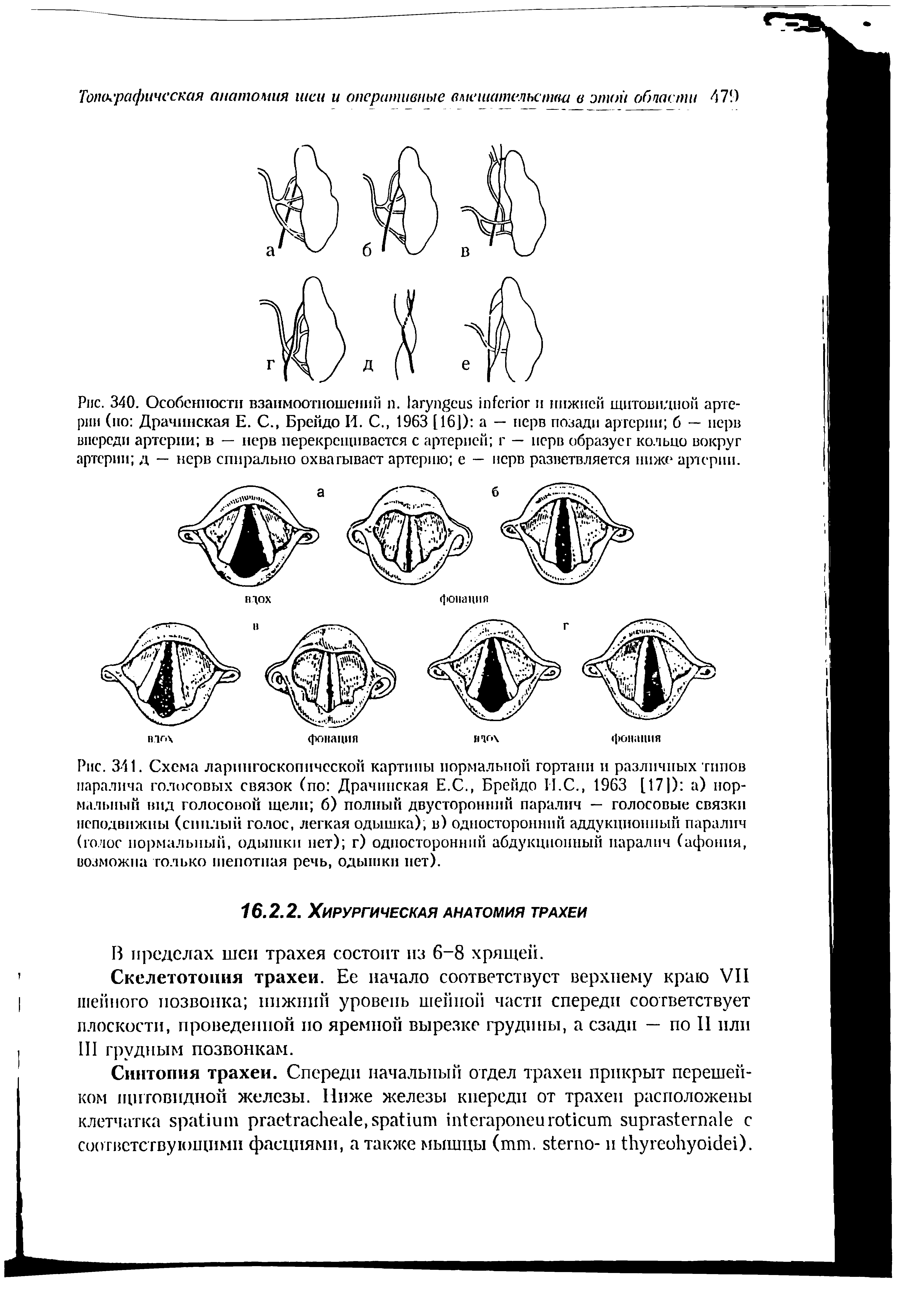 Рис. 340. Особенности взаимоотношений и. и нижней щитовидной артерии (но Драчинская Е. С., Брейдо И. С., 1963 [16]) а — нерв позади артерии б — нерв впереди артерии в — нерв перекрещивается с артерией г — нерв образует кольцо вокруг артерии д — нерв спирально охватывает артерию е — нерв разветвляется ниже артерии.