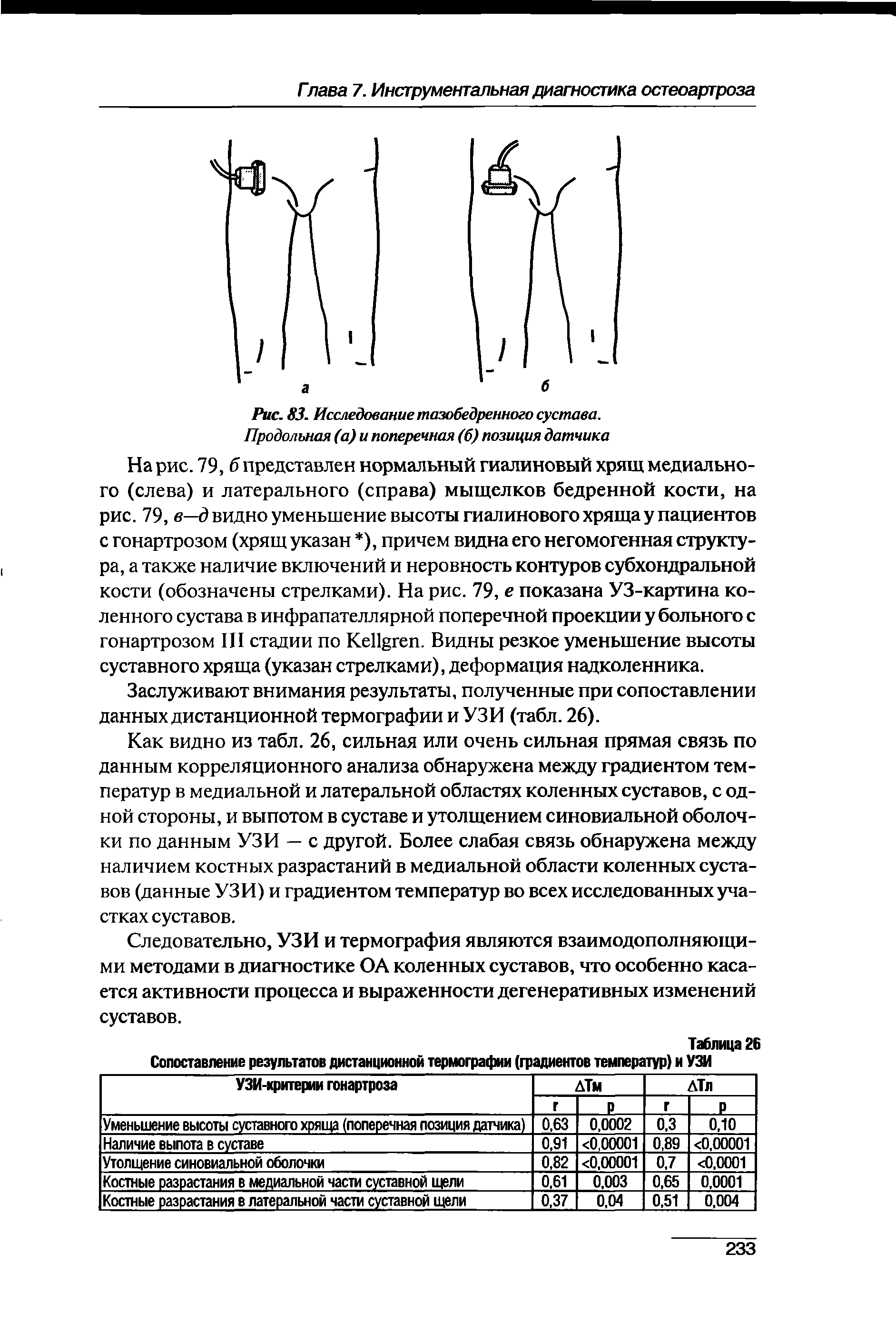 Рис. 83. Исследование тазобедренного сустава. Продольная (а) и поперечная (б) позиция датчика...