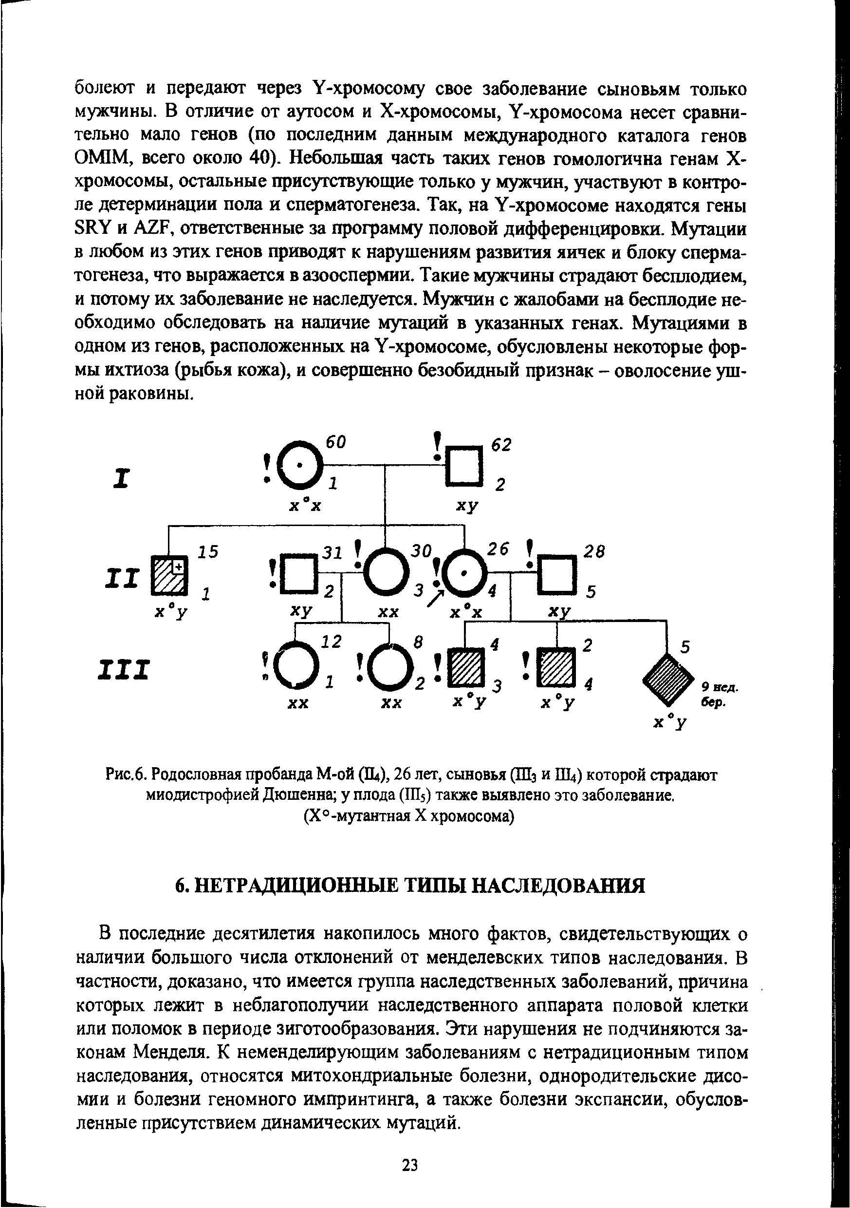 Рис.6. Родословная пробанда М-ой (Щ), 26 лет, сыновья (Шз и ГЩ) которой страдают миодистрофией Дюшенна у плода (Ш5) также выявлено это заболевание.