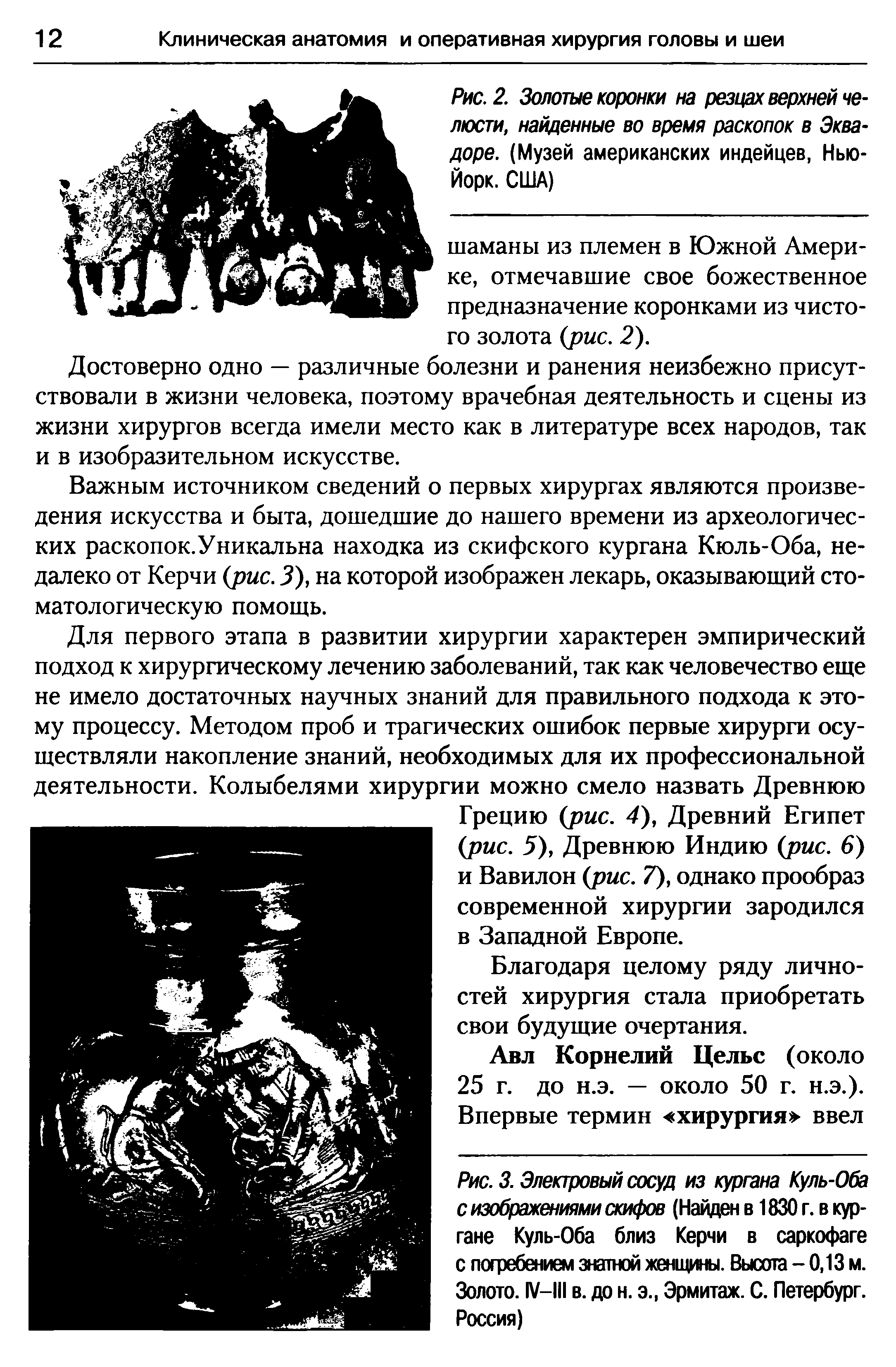 Рис. 3. Элекгровый сосуд из кургана Куль-Оба с изображениями скифов (Найден в 1830 г. в кургане Куль-Оба близ Керчи в саркофаге с погребением знатной женщины. Высота - 0,13 м. Золото. IV—III в. до н. э., Эрмитаж. С. Петербург. Россия)...