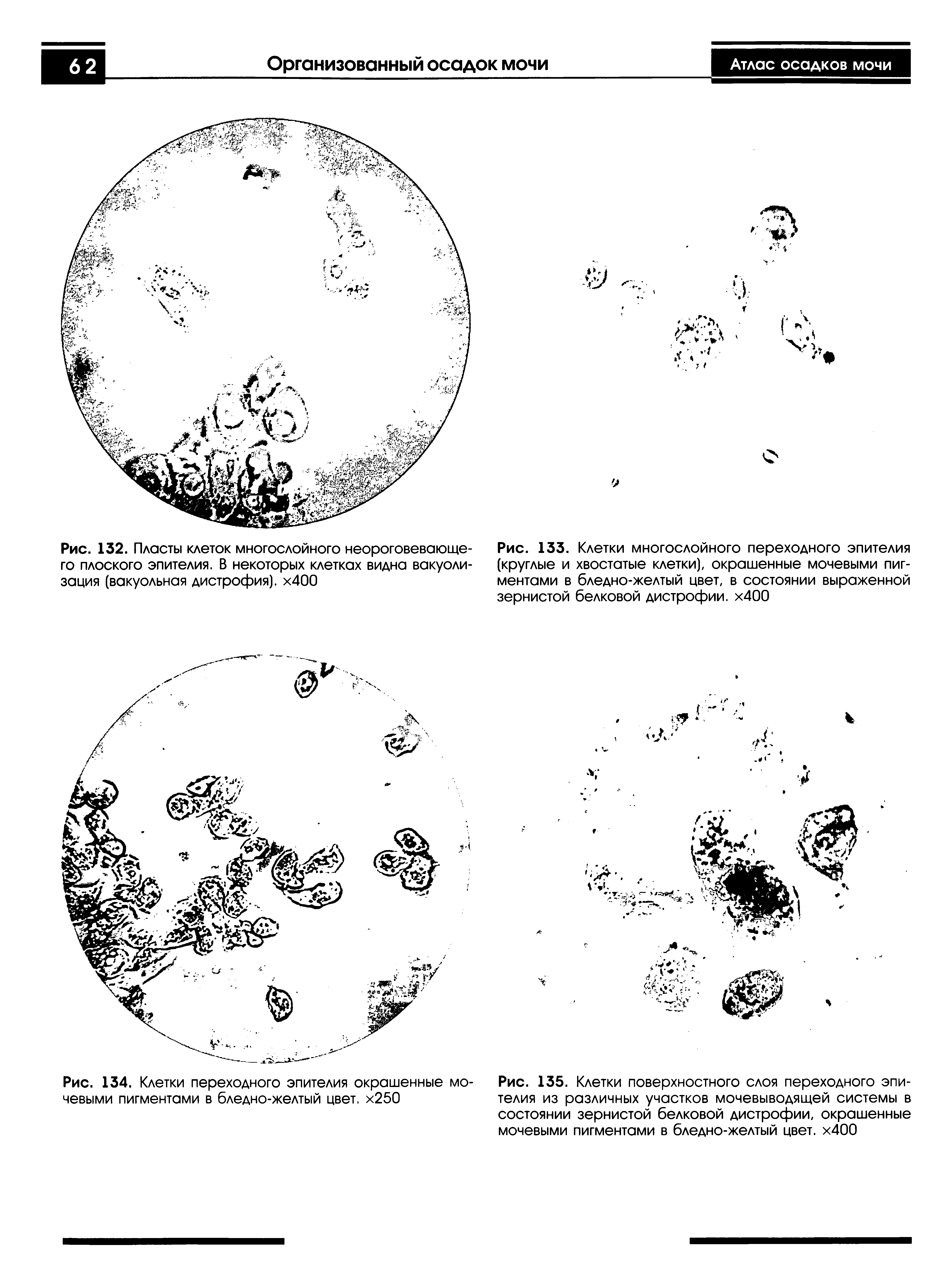 Рис. 134. Клетки переходного эпителия окрашенные мочевыми пигментами в бледно-желтый цвет. х250...