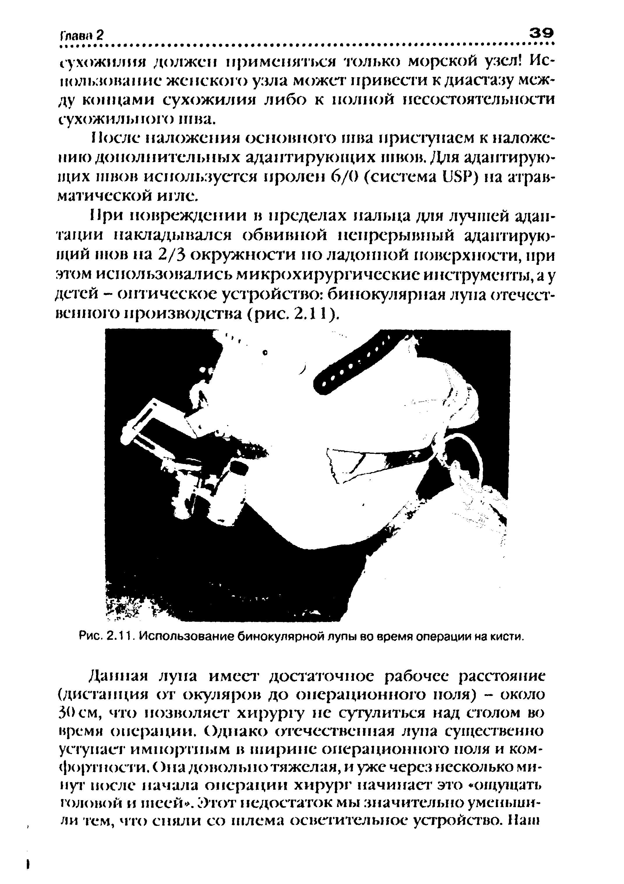 Рис. 2.11. Использование бинокулярной лупы во время операции на кисти.