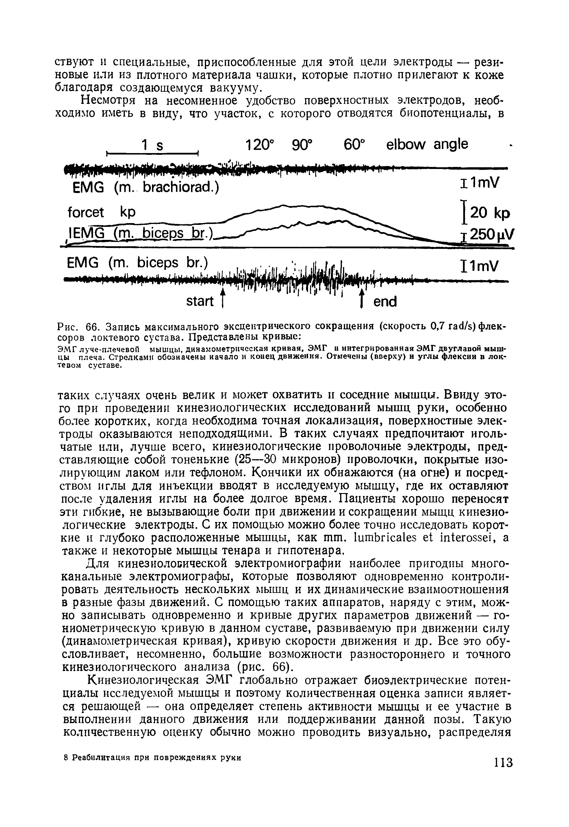 Рис. 66. Запись максимального эксцентрического сокращения (скорость 0,7 га Л) флексоров локтевого сустава. Представлены кривые ...