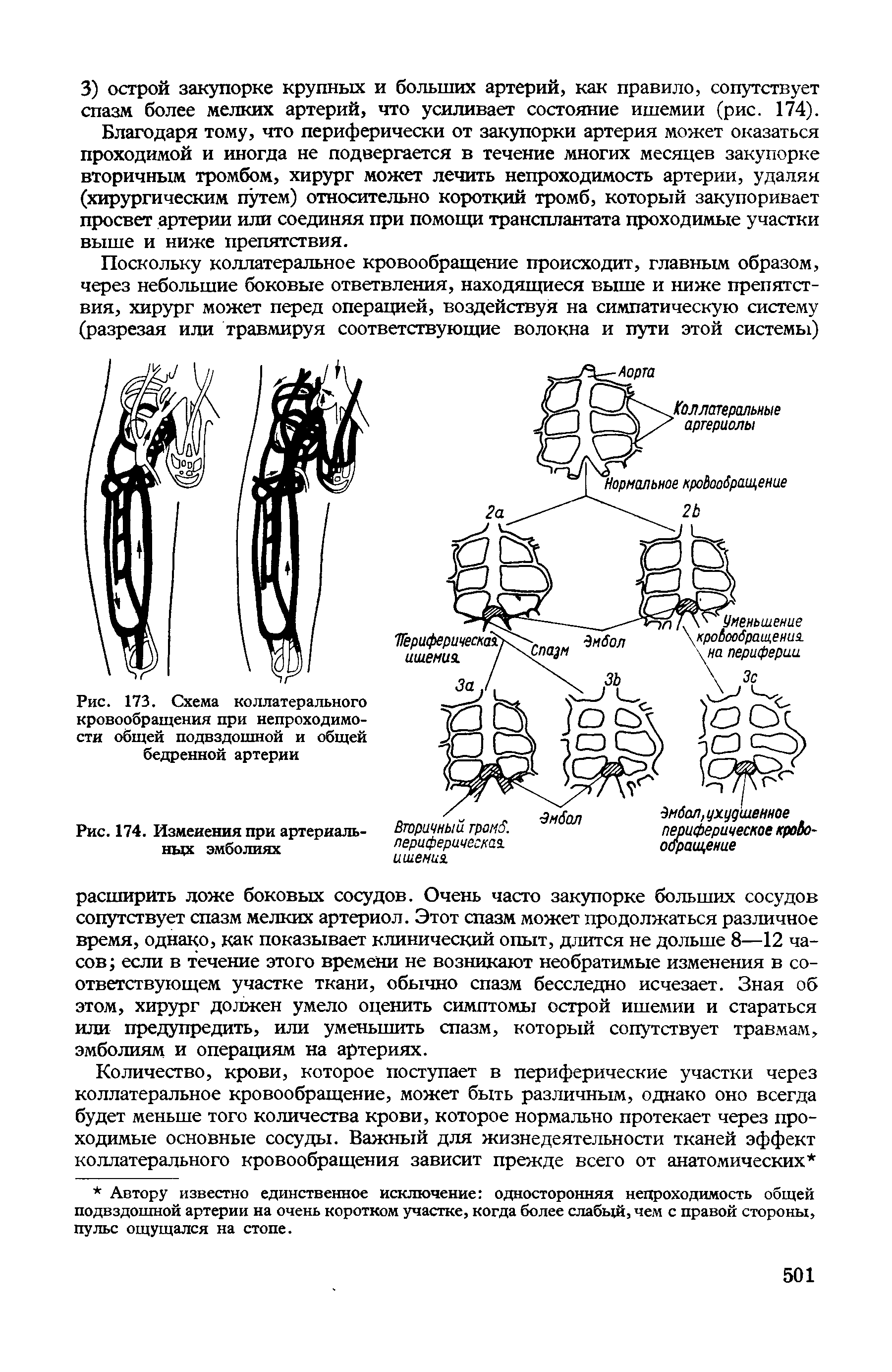 Рис. 173. Схема коллатерального кровообращения при непроходимости общей подвздошной и общей бедренной артерии...