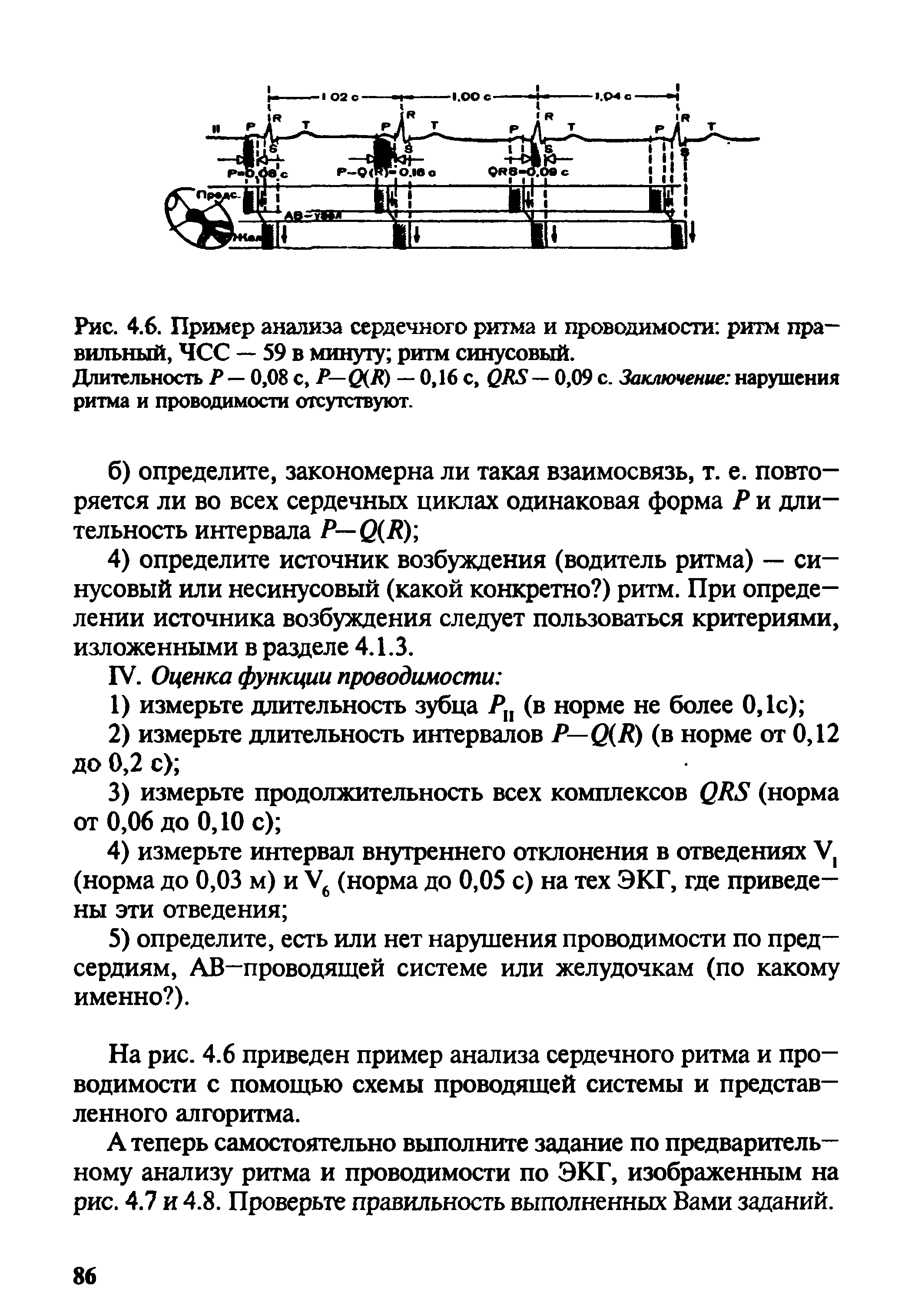 Рис. 4.6. Пример анализа сердечного ритма и проводимости ритм правильный, ЧСС — 59 в минуту ритм синусовый.