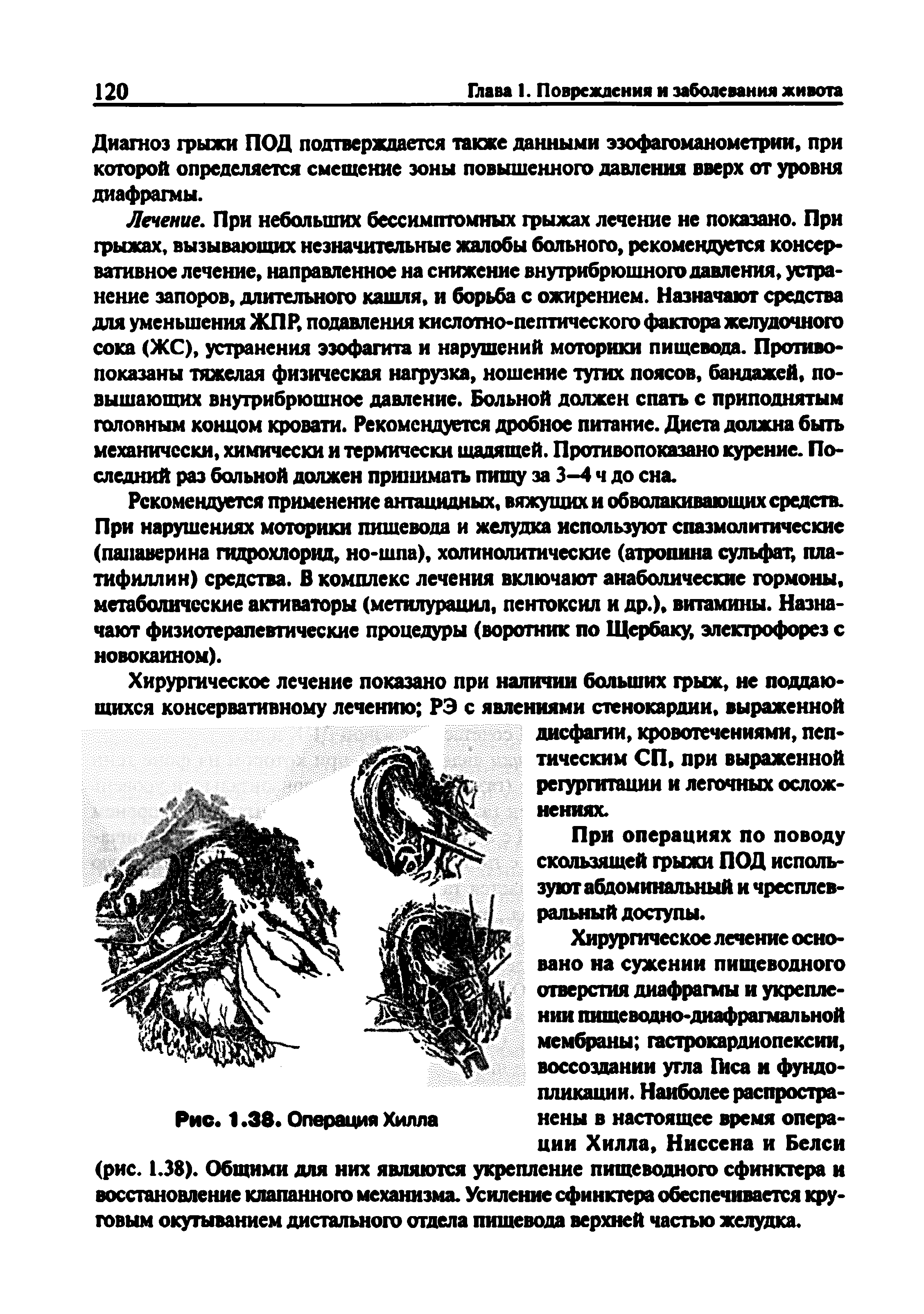 Рис. 1.38. Операция Хилла йены в настоящее время опера-...