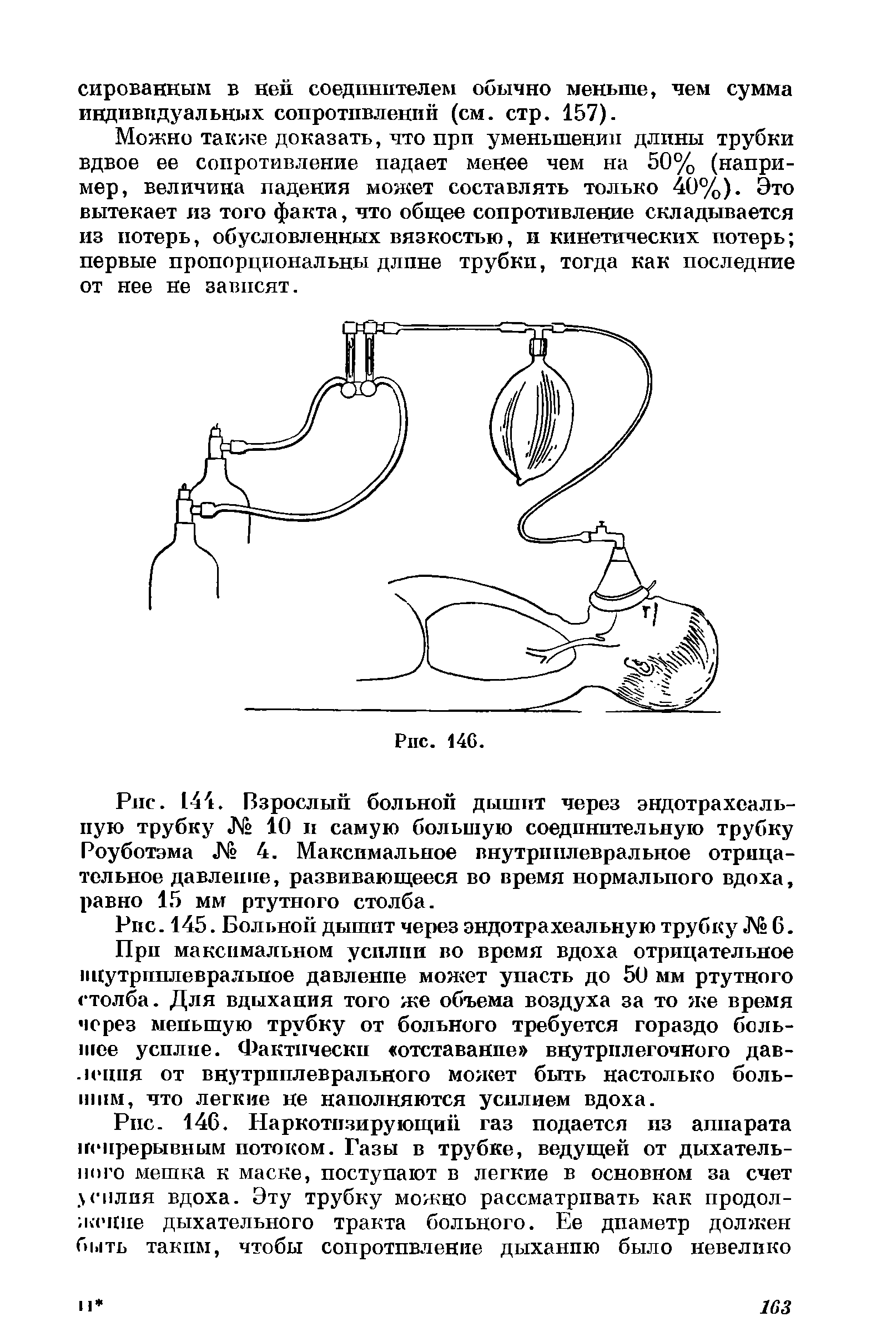 Рис. 144. Взрослый больной дышит через эндотрахеаль-пую трубку № 10 и самую большую соединительную трубку Роуботэма № 4. Максимальное внутриплевральное отрицательное давление, развивающееся во время нормального вдоха, равно 15 мм ртутного столба.