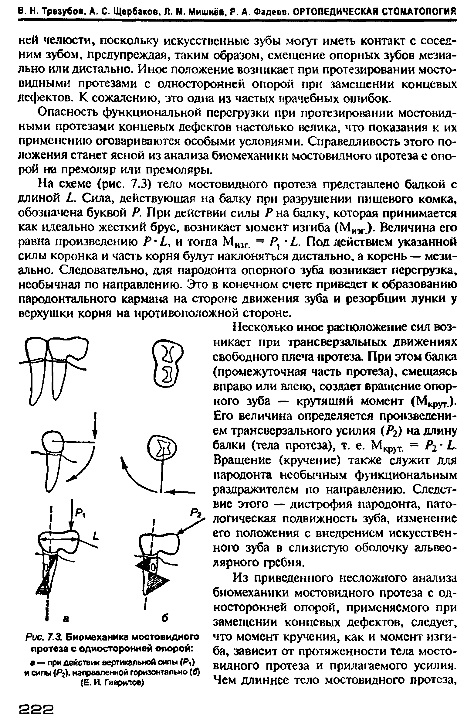 Рис. 7.3. Биомеханика мостовидного протеза с односторонней опорой в — при действии вертикальной сипы (Р,) и сипы (Р ), направленной горизонтально (б) (Е. И. Гаврилоо)...