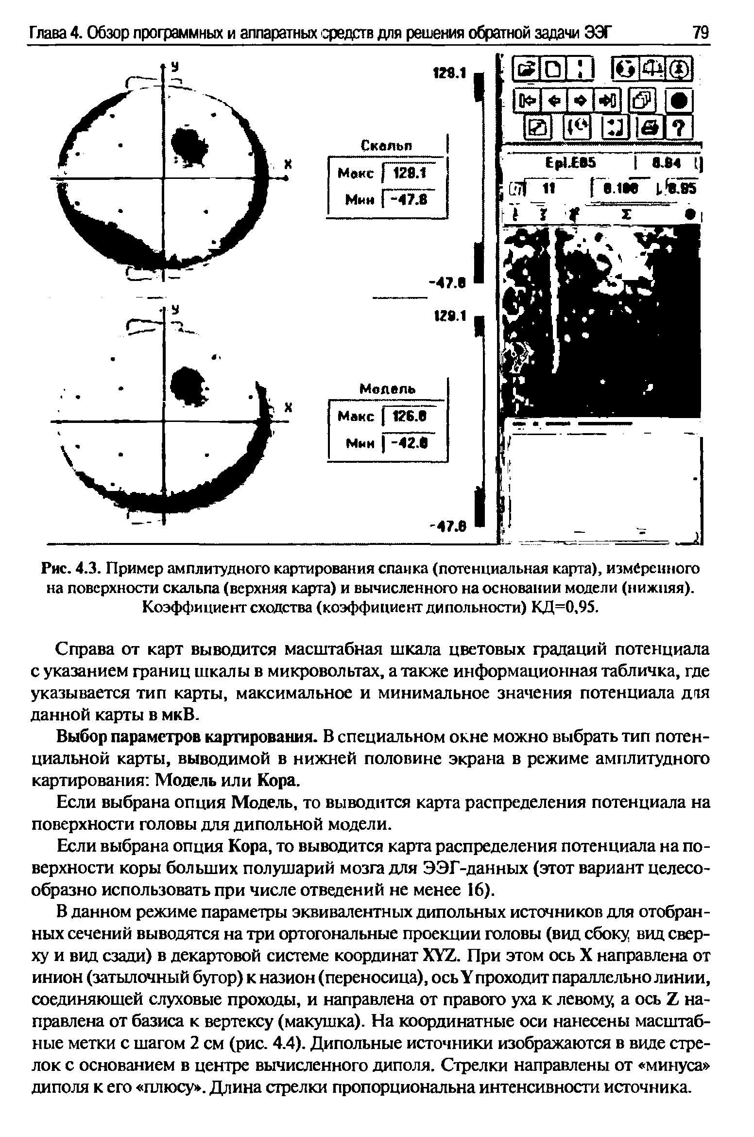 Рис. 4.3. Пример амплитудного картирования спайка (потенциальная карта), измеренного на поверхности скальпа (верхняя карта) и вычисленного на основании модели (нижняя). Коэффициент сходства (коэффициент дипольности) КД=0,95.