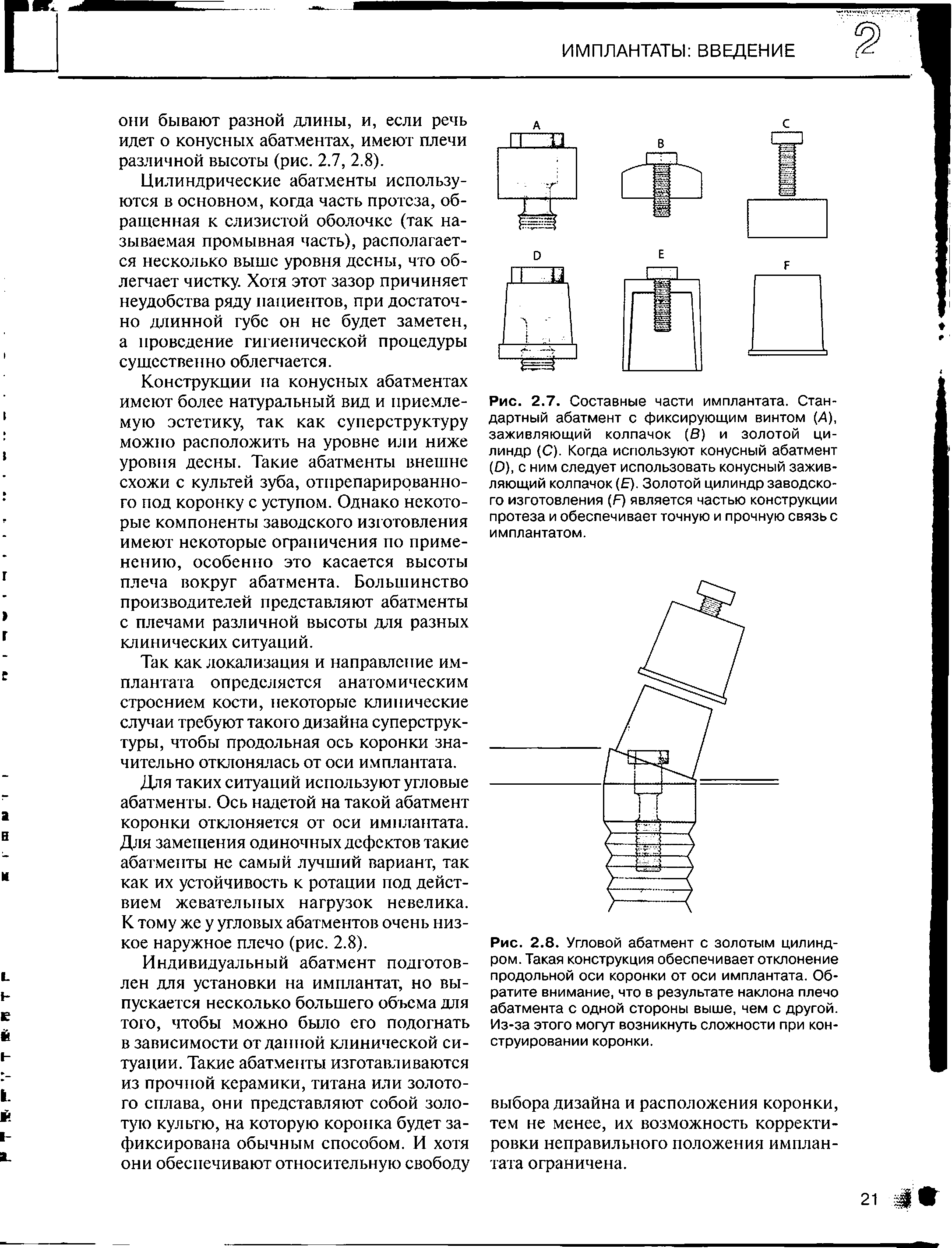 Рис. 2.8. Угловой абатмент с золотым цилиндром. Такая конструкция обеспечивает отклонение продольной оси коронки от оси имплантата. Обратите внимание, что в результате наклона плечо абатмента с одной стороны выше, чем с другой. Из-за этого могут возникнуть сложности при конструировании коронки.