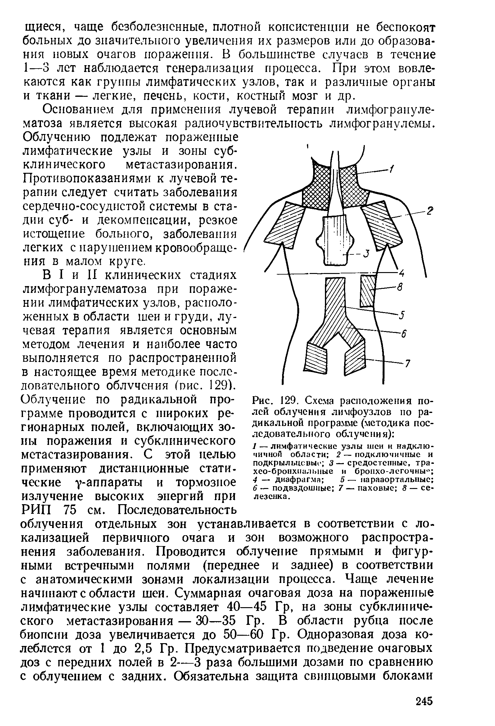 Рис. 129. Схема расположения полей облучения лимфоузлов по радикальной программе (методика последовательного облучени я) ...