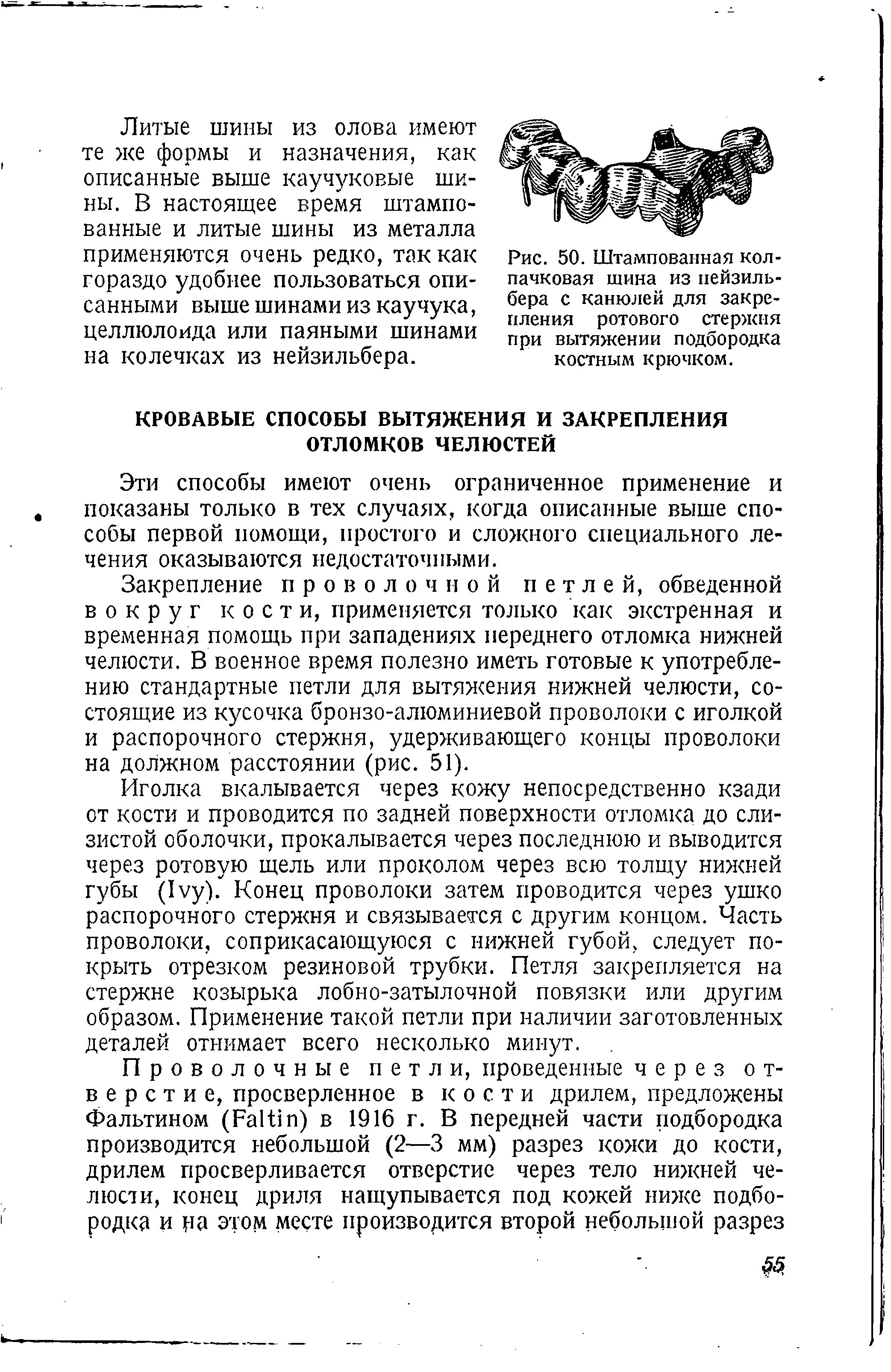 Рис. 50. Штампованная колпачковая шина из нейзильбера с канюлей для закрепления ротового стержня при вытяжении подбородка костным крючком.