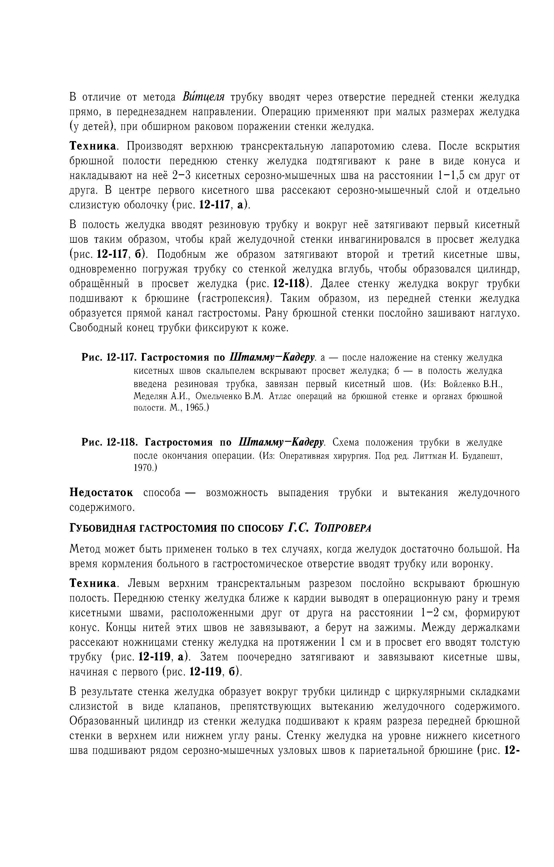 Рис. 12-117. Гастростомия по Штамму—Кадеру, а — после наложение на стенку желудка кисетных швов скальпелем вскрывают просвет желудка б — в полость желудка введена резиновая трубка, завязан первый кисетный шов. (Из Войленко В.Н., Меделян А.И., Омельченко В.М. Атлас операций на брюшной стенке и органах брюшной полости. М., 1965.)...