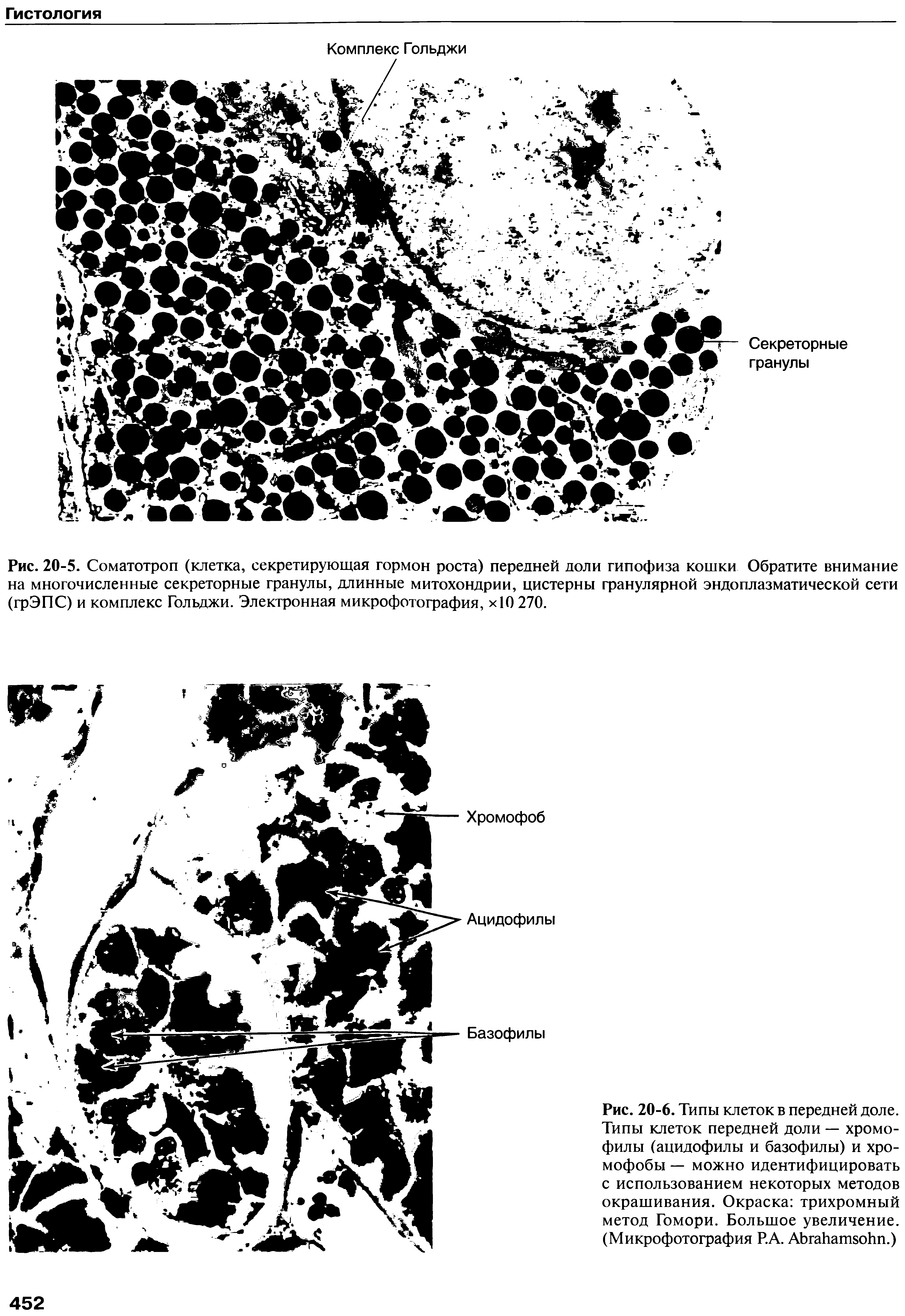 Рис. 20-6. Типы клеток в передней доле. Типы клеток передней доли — хромофилы (ацидофилы и базофилы) и хромофобы — можно идентифицировать с использованием некоторых методов окрашивания. Окраска трихромный метод Гомори. Большое увеличение. (Микрофотография Р.А. АбгайатзоИп.)...