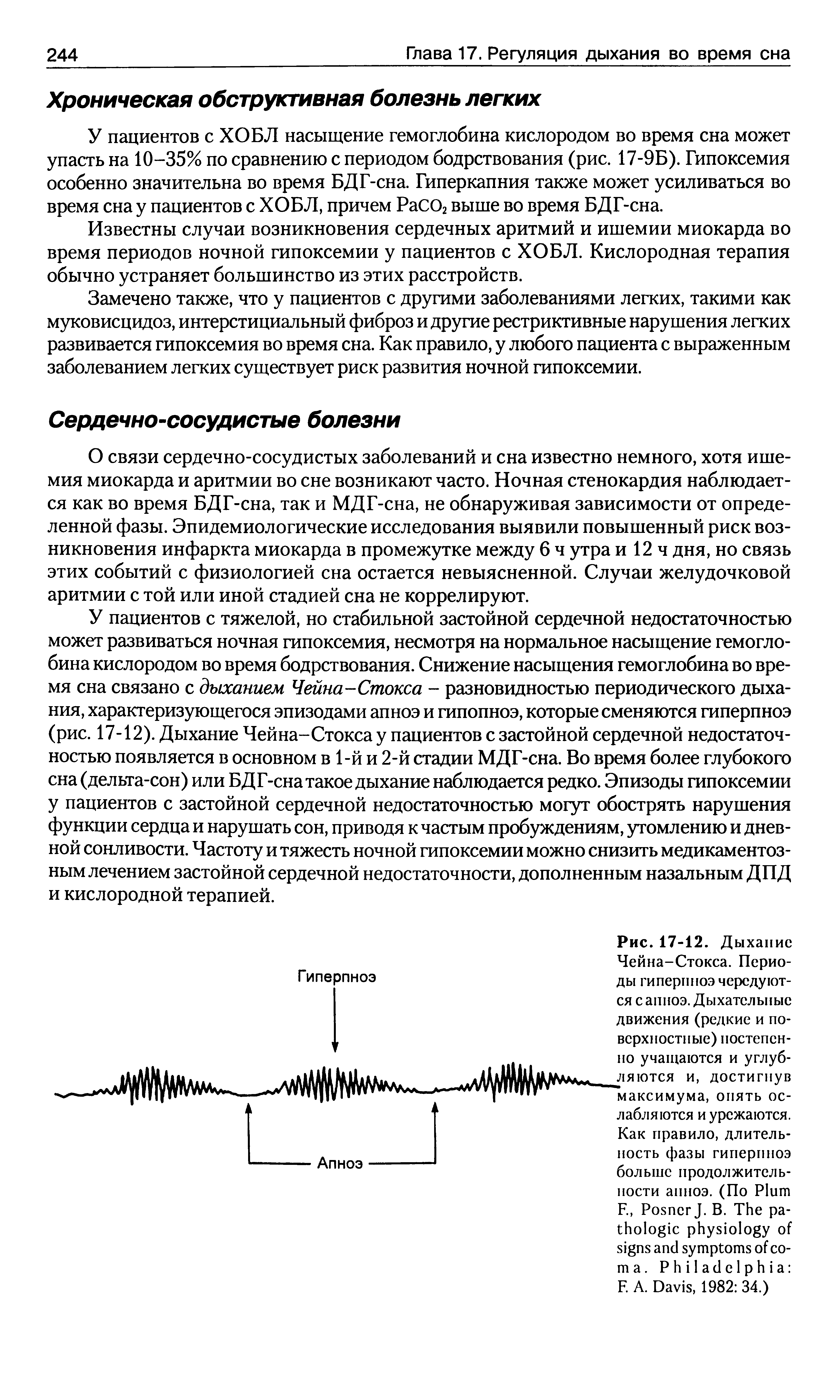 Рис. 17-12. Дыхание Чейна-Стокса. Периоды гиперпноэ чередуются с апноэ. Дыхательные движения (редкие и поверхностные) постепенно учащаются и углубляются и, достигнув максимума, опять ослабляются и урсжаются. Как правило, длительность фазы гиперпноэ больше продолжительности апноэ. (По P ...