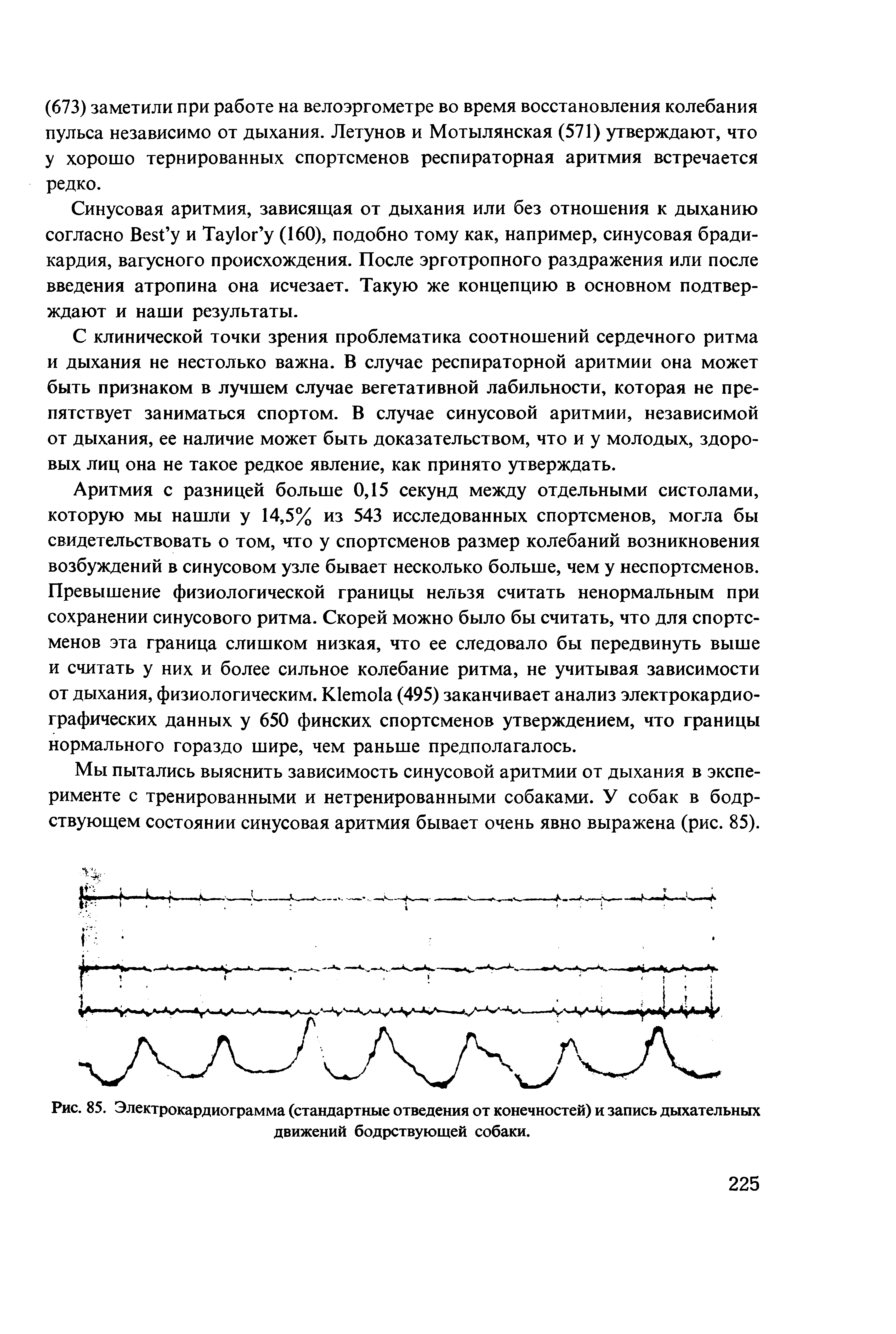 Рис. 85. Электрокардиограмма (стандартные отведения от конечностей) и запись дыхательных движений бодрствующей собаки.