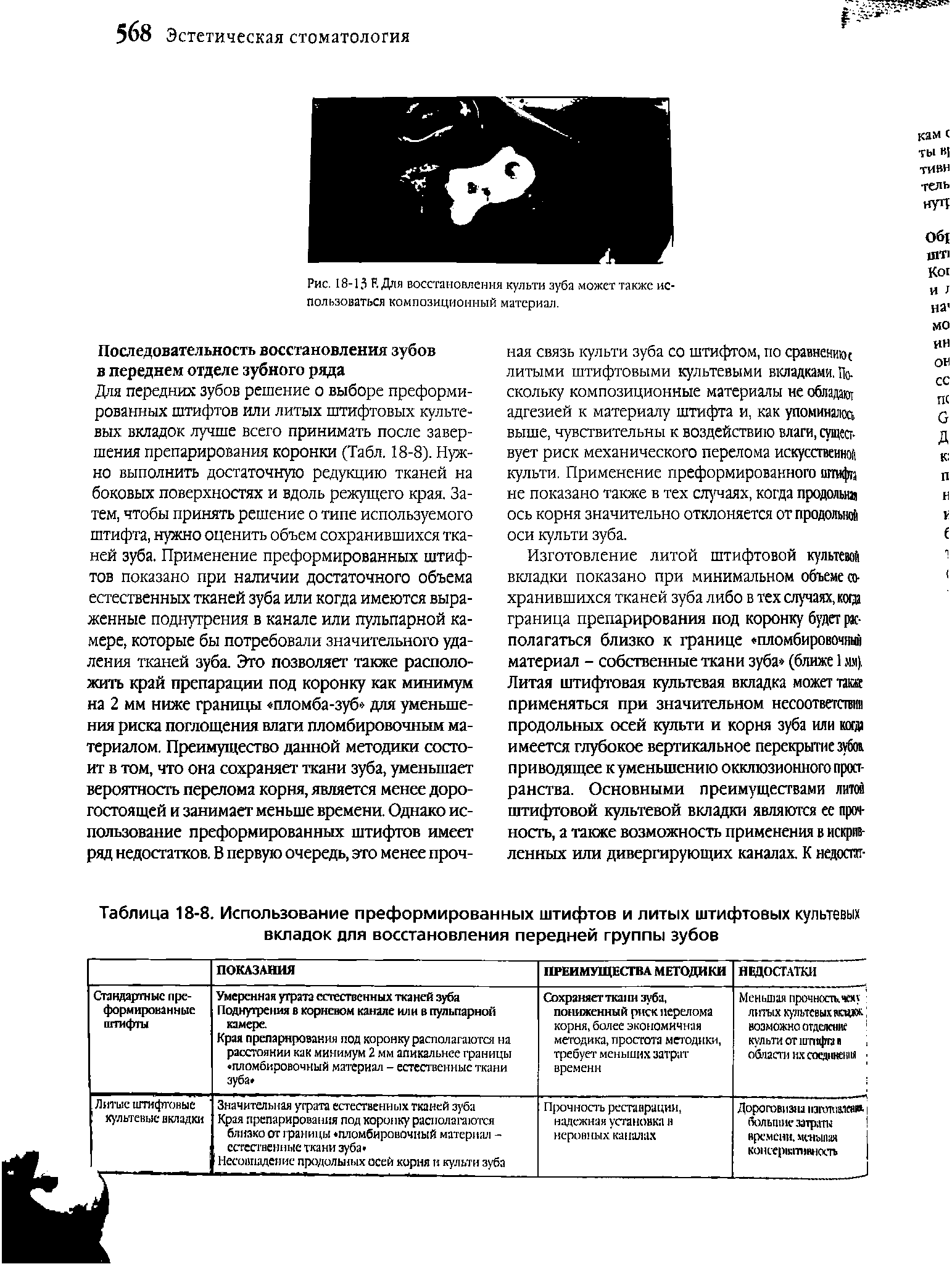 Таблица 18-8. Использование преформированных штифтов и литых штифтовых культевых вкладок для восстановления передней группы зубов...