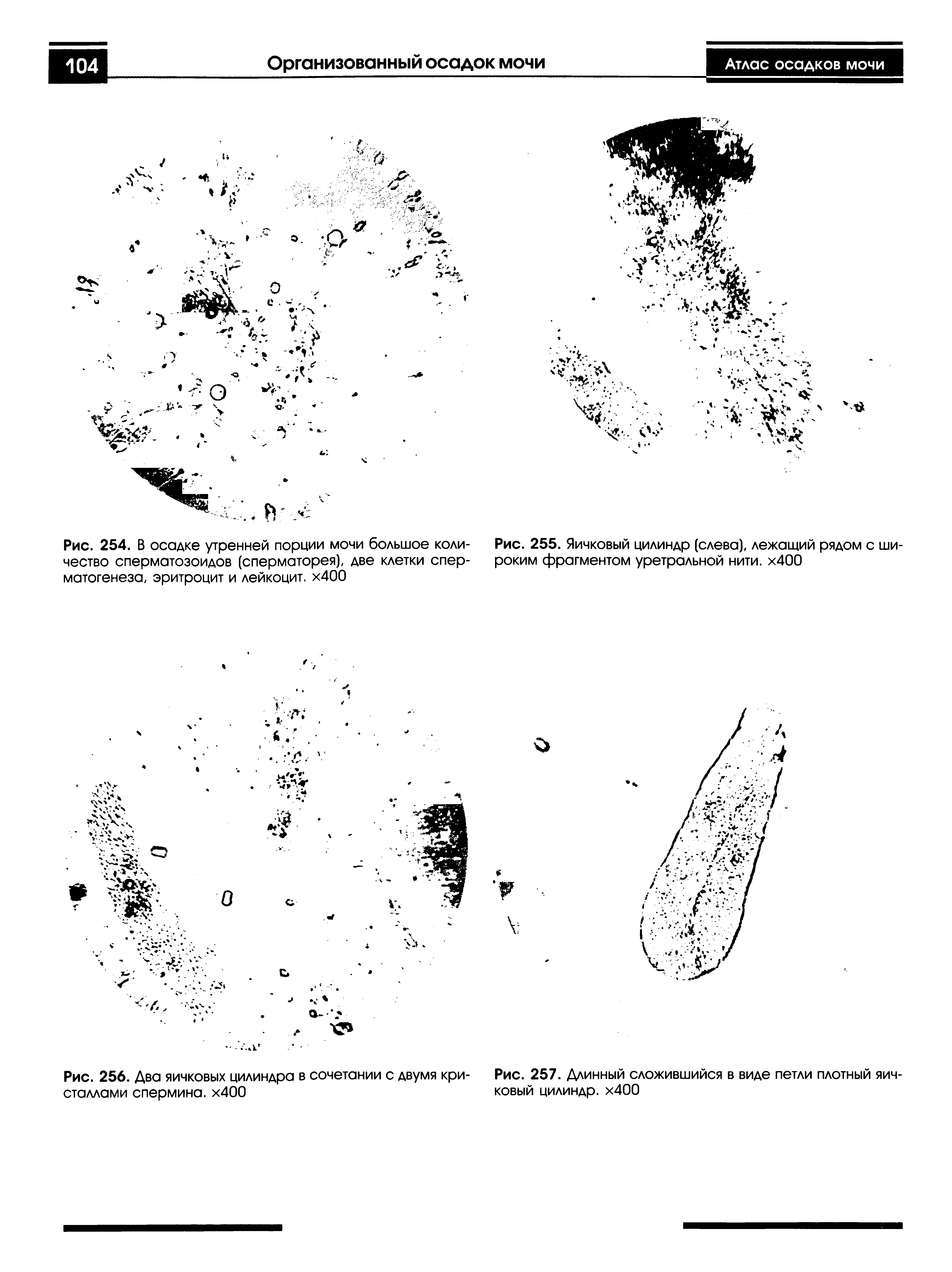 Рис. 255. Яичковый цилиндр (слева), лежащий рядом с широким фрагментом уретральной нити. х400...