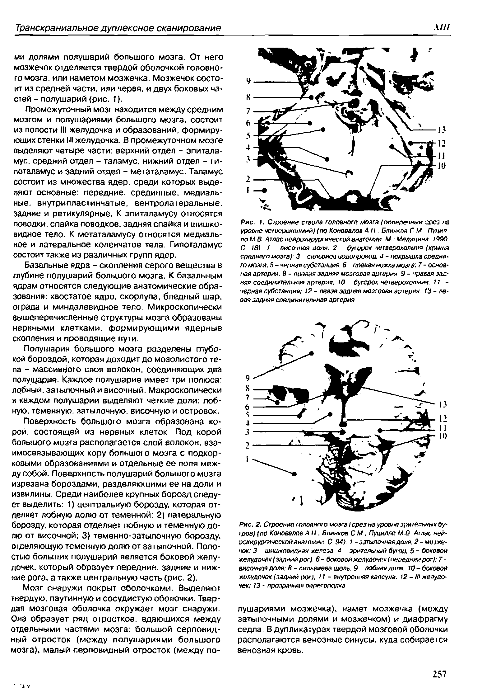 Рис. 2. Строение а>лонм<яо мозга (срез на уровне зри(ёлнны бугров) (по Коновалов А Н. Блинков С М. Пуцилло М.8 Ашас нейрохирургической анатомии С 94) 1 -затылочнаядоля.2-мозжечок 3 шишковидная железа 4 зрительный бу/оо. 5-боковой желудочек (.задний рог). 6 - боковой желудочек (передний рог) 7 височная доля. В - сильвиева щель 9 лобная доля. 10 - боковой желудочек (задний юг) 11 - внутренняя капсула. >2 - Ш желудочек 13 - прозрачная перегородка...