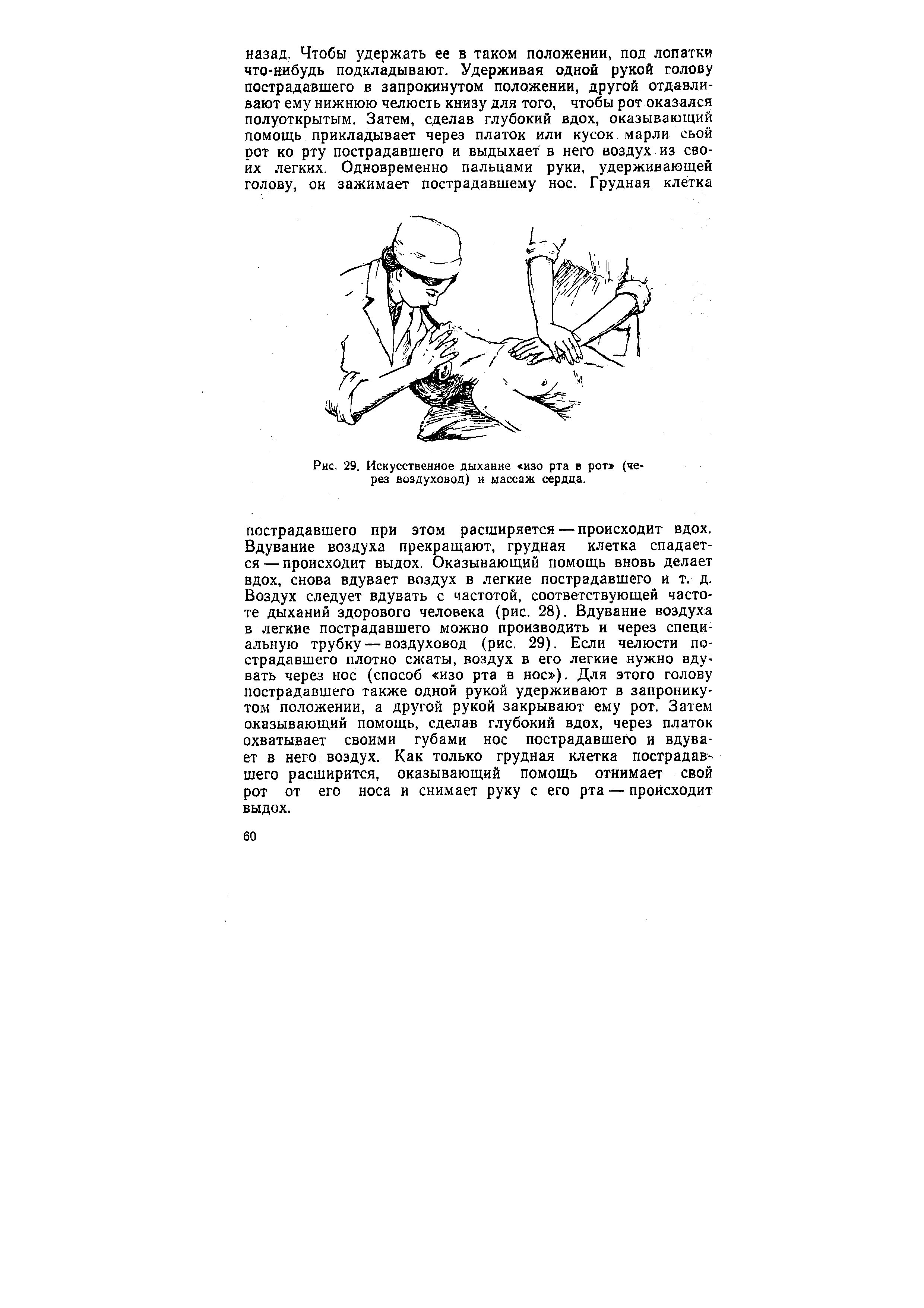 Рис. 29. Искусственное дыхание изо рта в рот (через воздуховод) и массаж сердца.
