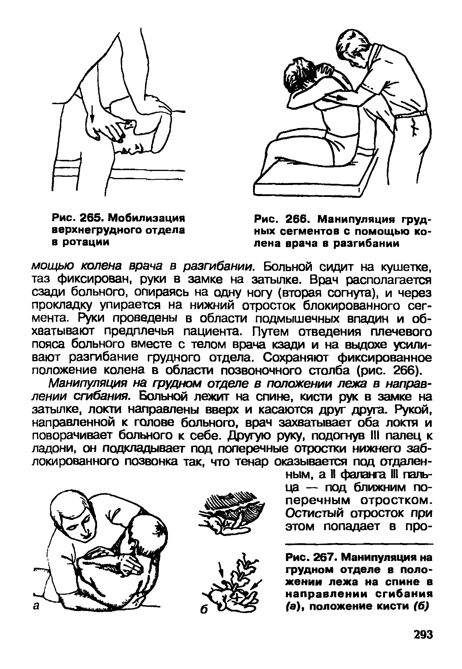 Рис. 267. Манипуляция на грудном отделе в положении лежа на спине в направлении сгибания (а), положение кисти (б)...