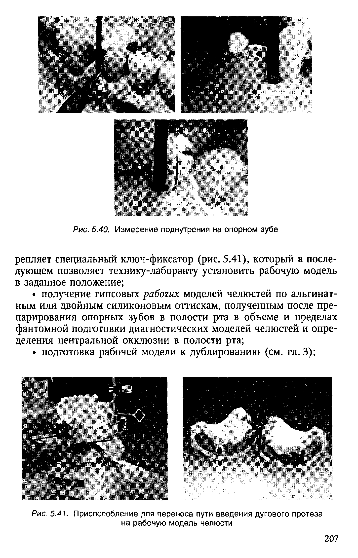 Рис. 5.41. Приспособление для переноса пути введения дугового протеза на рабочую модель челюсти...