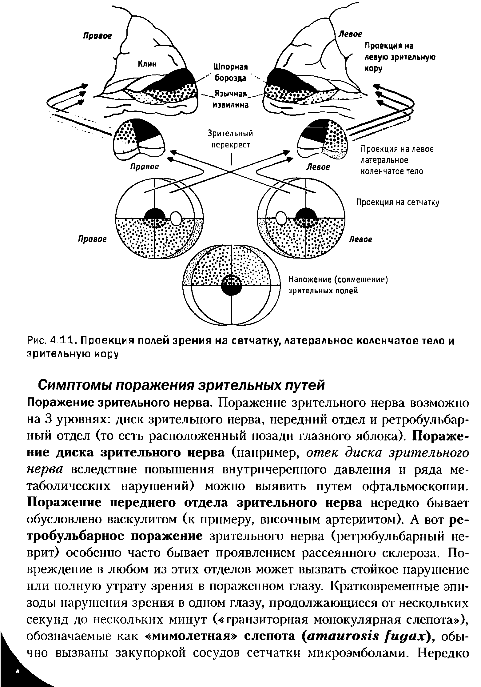 Рис. 4.11, Проекция полей зрения на сетчатку, латеральное коленчатое тело и зрительную кору...