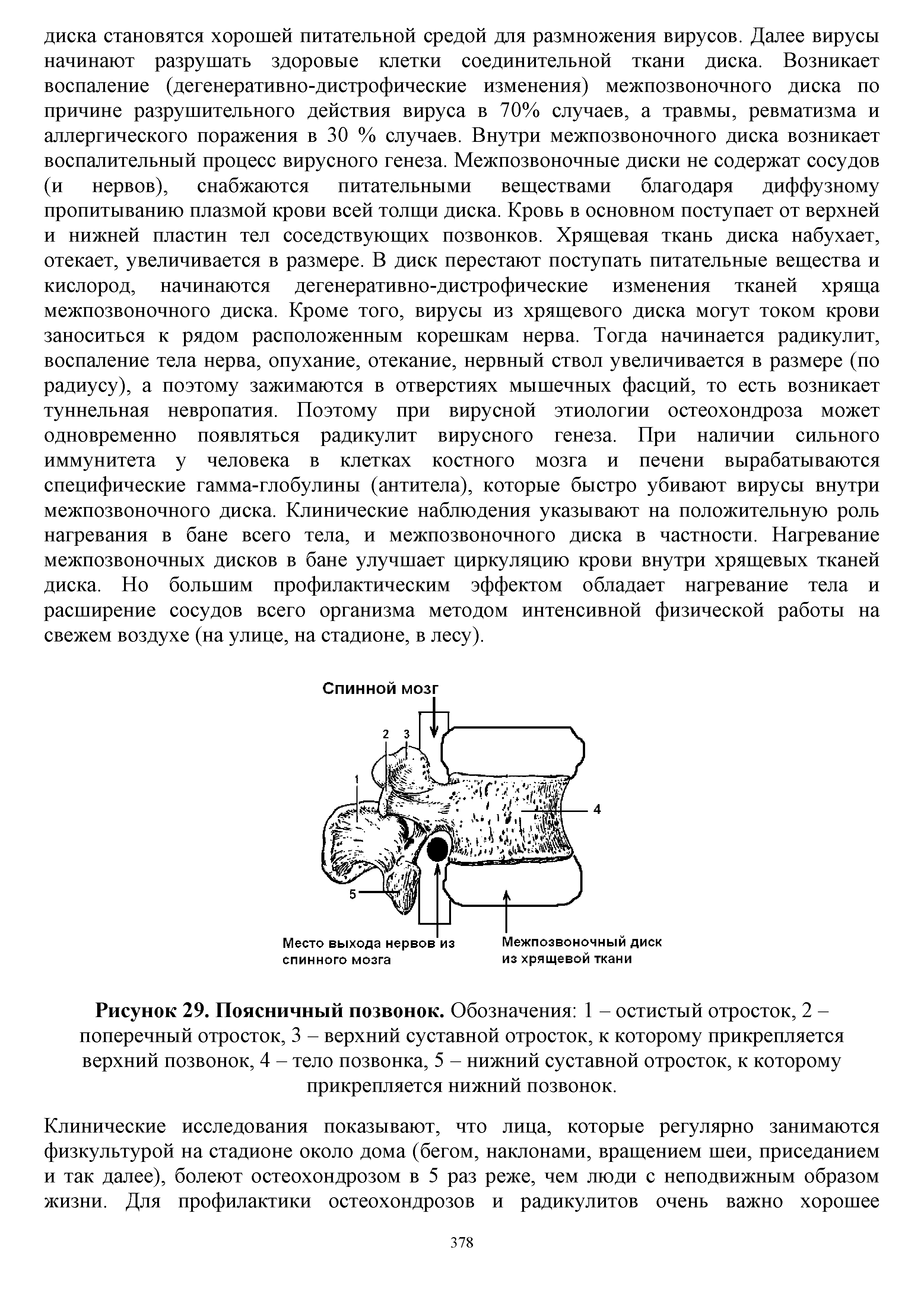 Рисунок 29. Поясничный позвонок. Обозначения 1 - остистый отросток, 2 -поперечный отросток, 3 - верхний суставной отросток, к которому прикрепляется верхний позвонок, 4 - тело позвонка, 5 - нижний суставной отросток, к которому прикрепляется нижний позвонок.