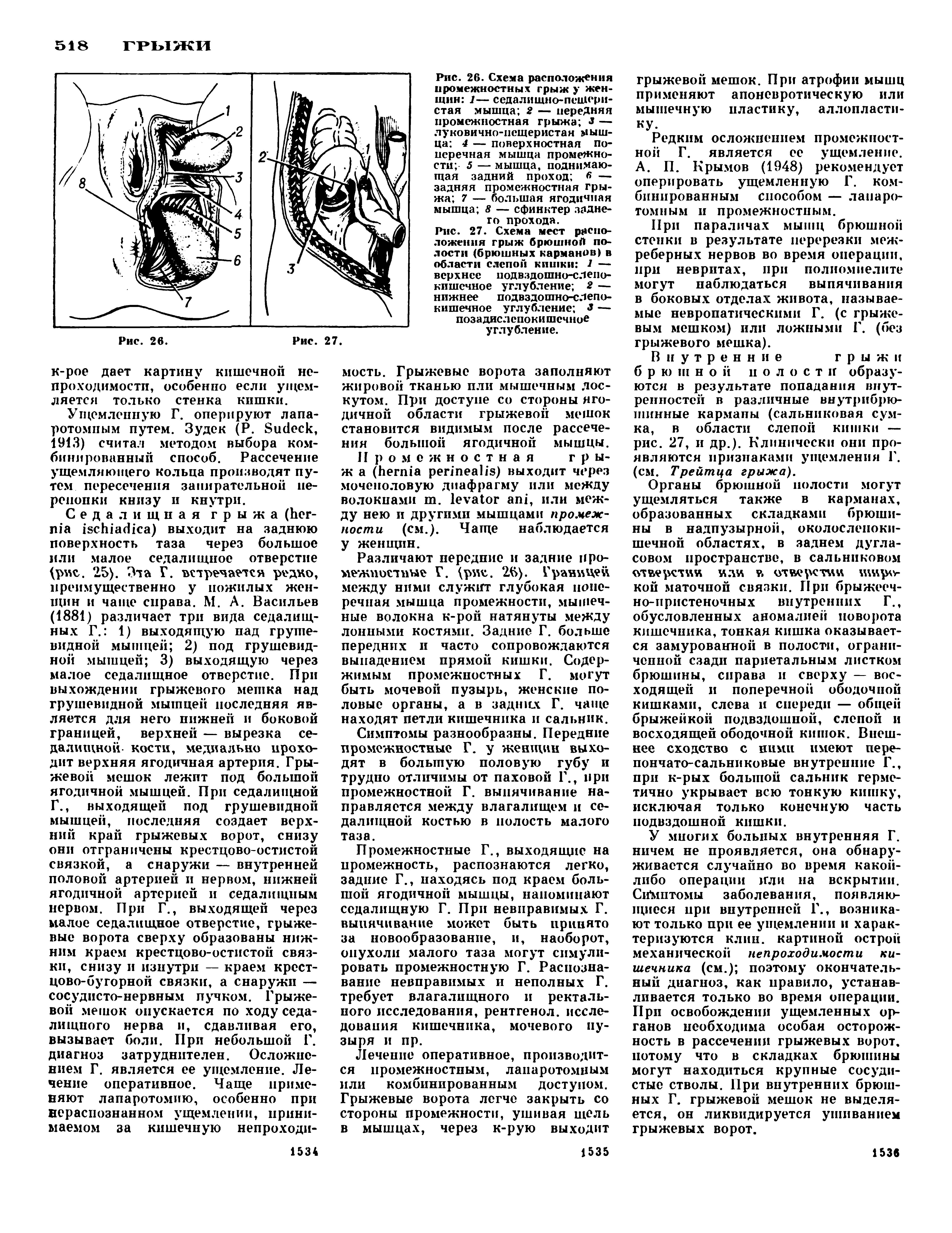 Рис. 27. Схема мест расположения грыж брюшной полости (брюшных карманов) в области слепой кишки 1 — верхнее подвздошно-слепокишечное углубление 2 — нижнее подвздошно-слепокишечное углубление 8 — позадислепокишечное углубление.