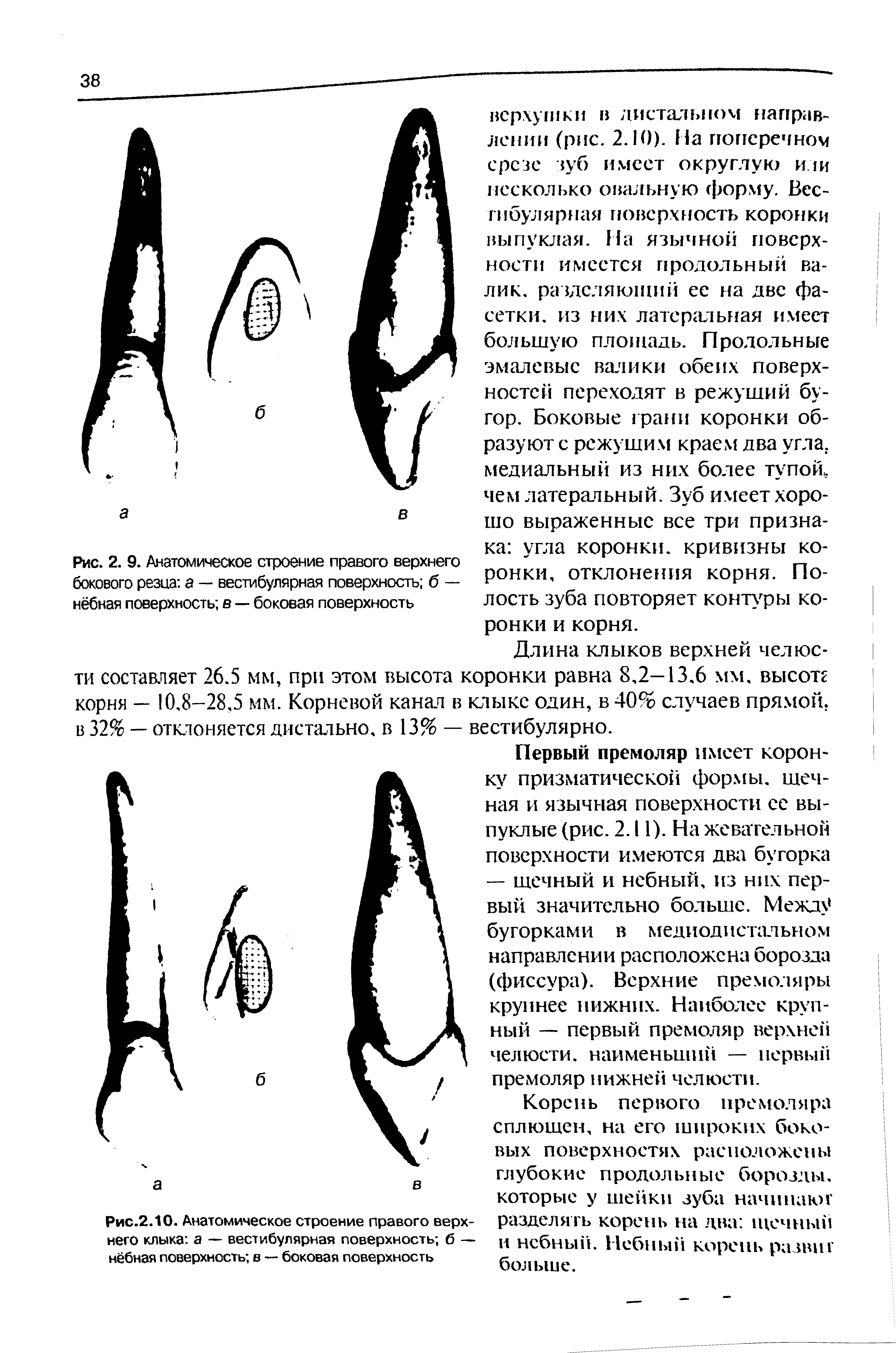 Рис.2.10. Анатомическое строение правого верхнего клыка а — вестибулярная поверхность б — нёбная поверхность в — боковая поверхность...