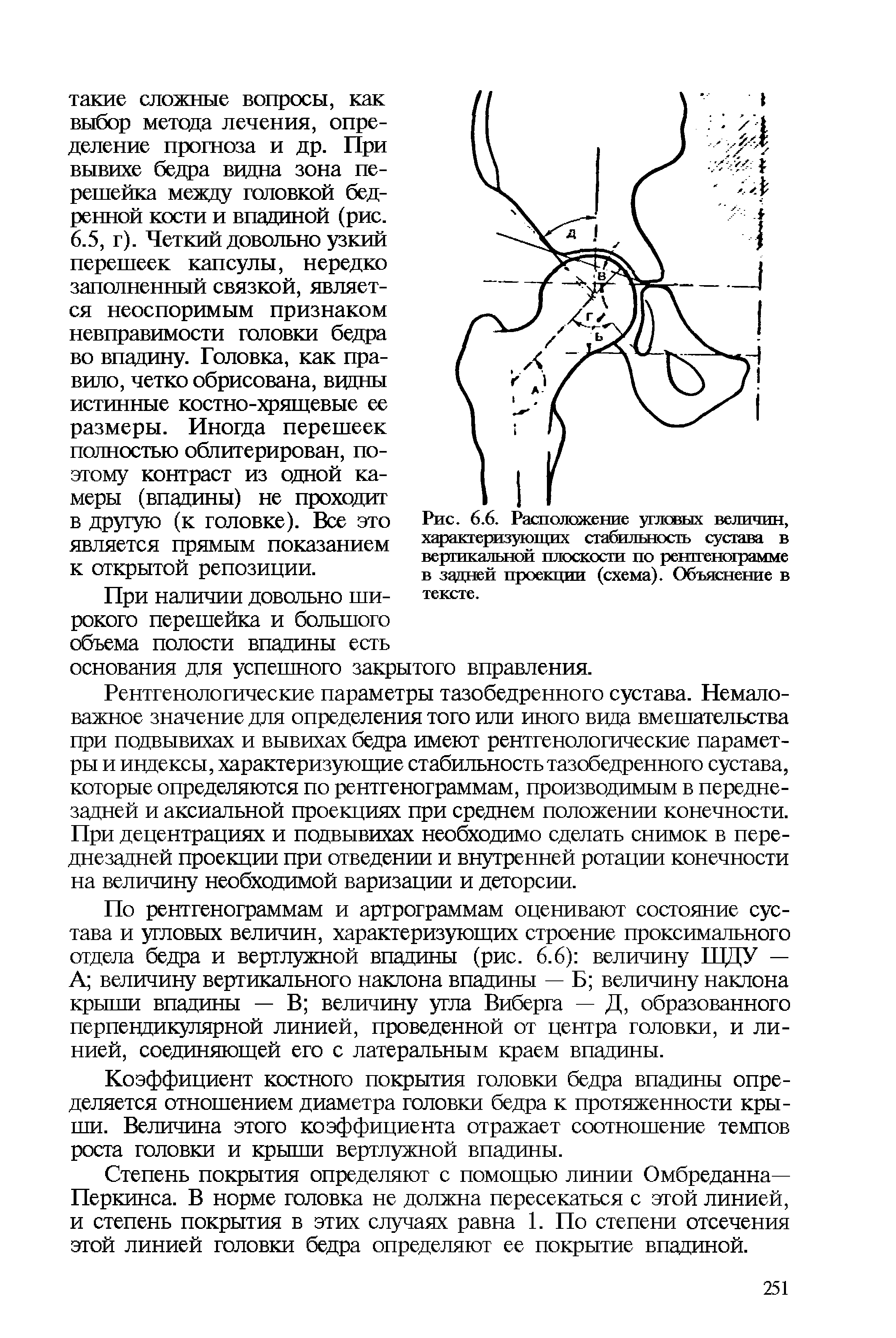 Рис. 6.6. Расположение углевых величин, характеризующих стабильность сустава в вертикальной плоскости по рентгенограмме в задней проекции (схема). Объяснение в тексте.