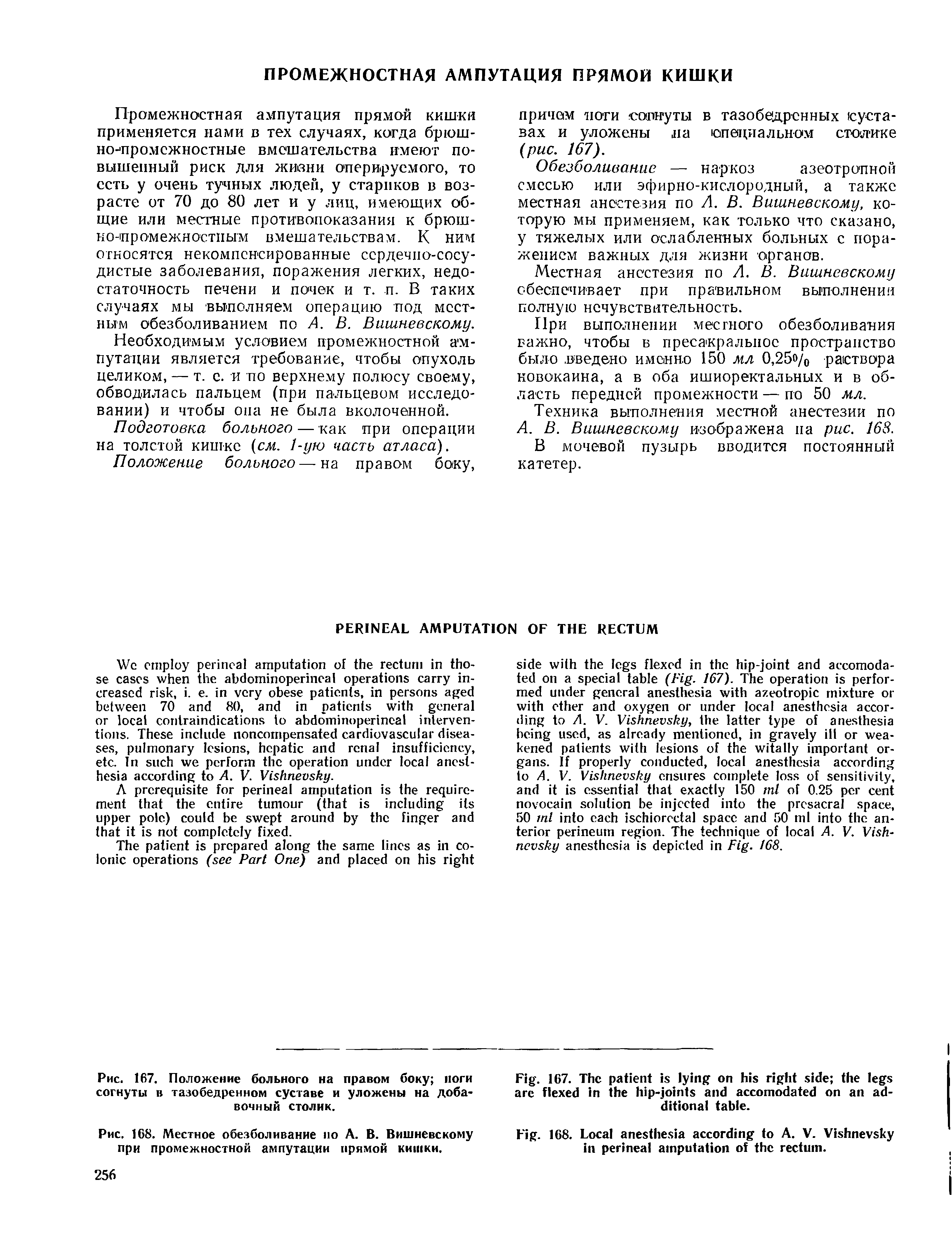 Рис. 168. Местное обезболивание по А. В. Вишневскому при промежностной ампутации прямой кишки.