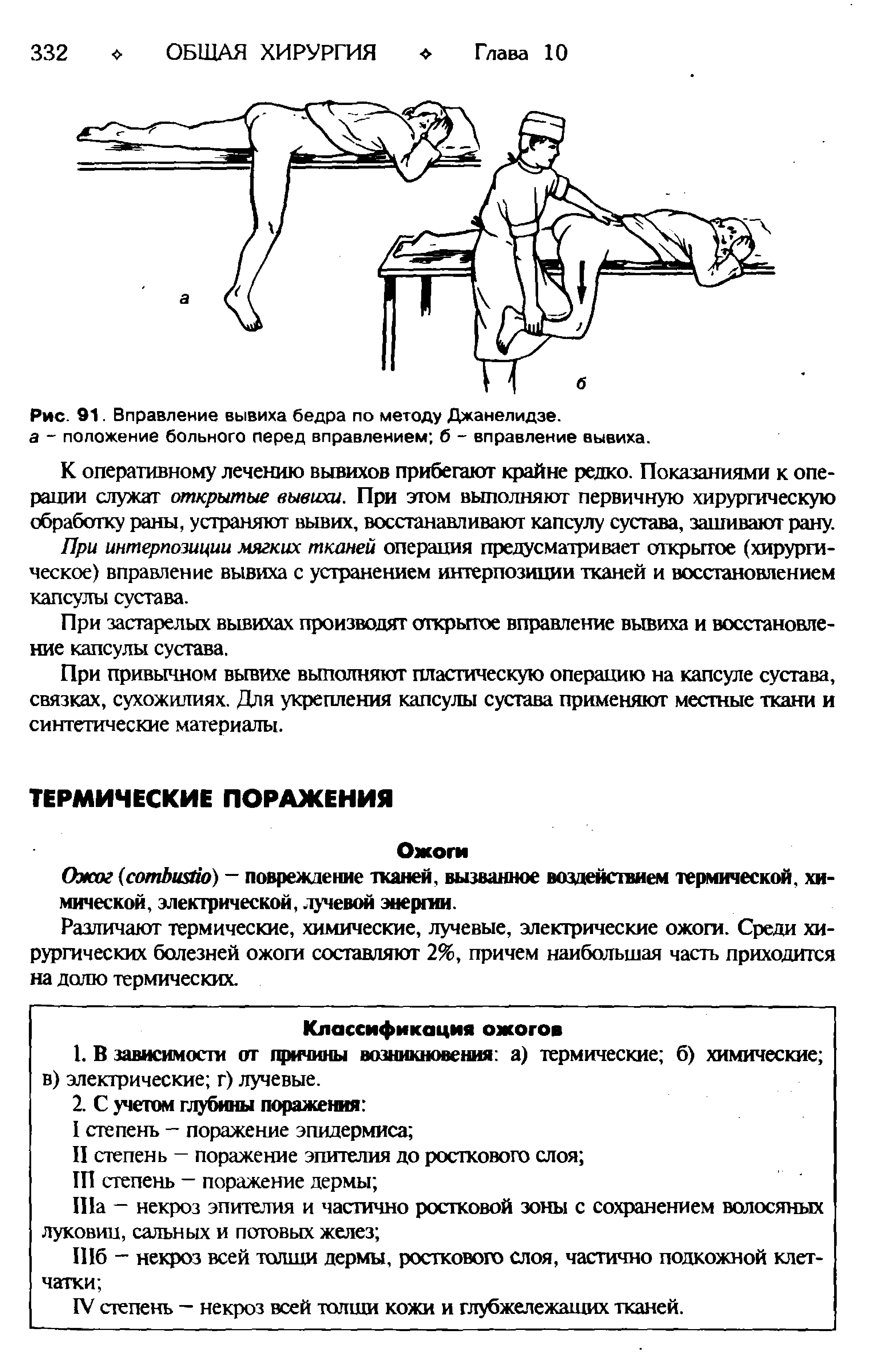 Рис. 91. Вправление вывиха бедра по методу Джанелидзе. а - положение больного перед вправлением б - вправление вывиха.