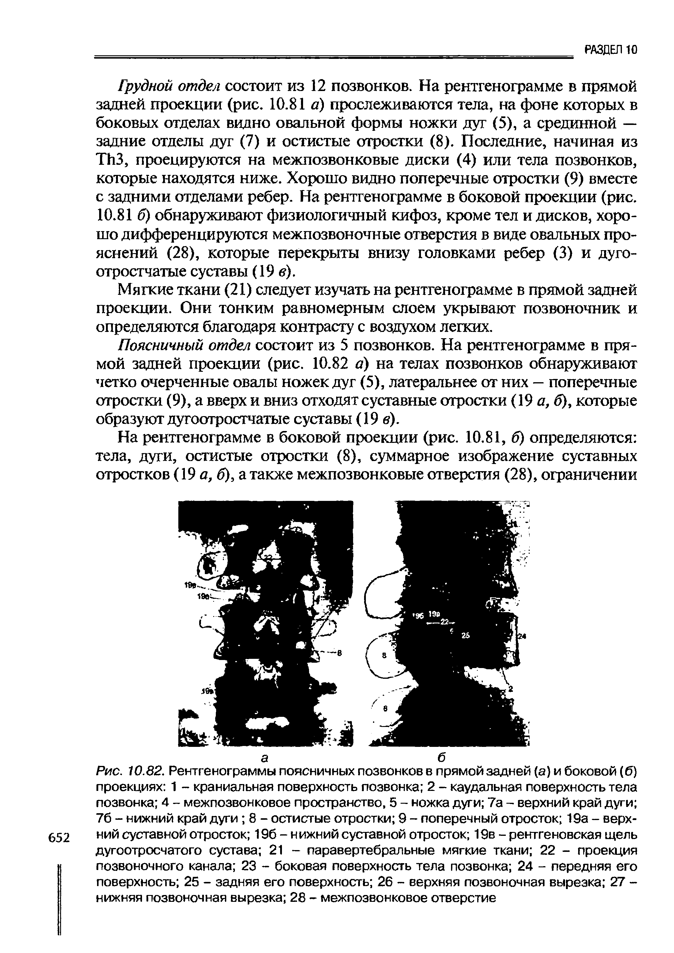 Рис. 10.82. Рентгенограммы поясничных позвонков в прямой задней (а) и боковой (б) проекциях 1 - краниальная поверхность позвонка 2 - каудальная поверхность тела позвонка 4 - межпозвонковое пространство, 5 - ножка дуги 7а - верхний край дуги 76 - нижний край дуги 8 - остистые отростки 9 - поперечный отросток 19а - верх-652 ний суставной отросток 196 - н ижний суставной отросток 19в - рентгеновская щель...