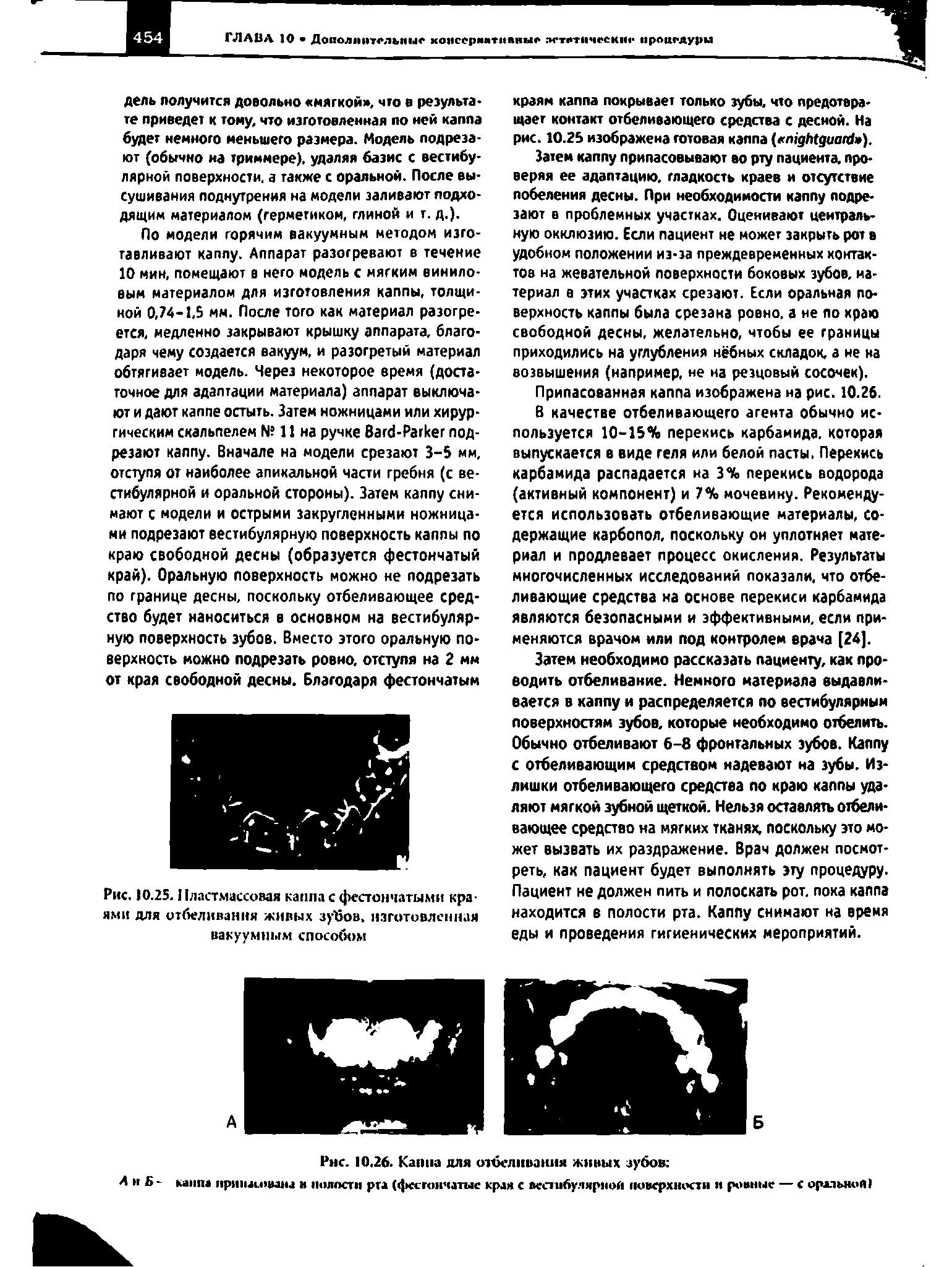 Рис. 10,26. Канна для отбеливания живых зубов капп нршыичшы н полости рта (фестончатые края с пестибулярмоп поверхности и ровные — с оральяоП)...