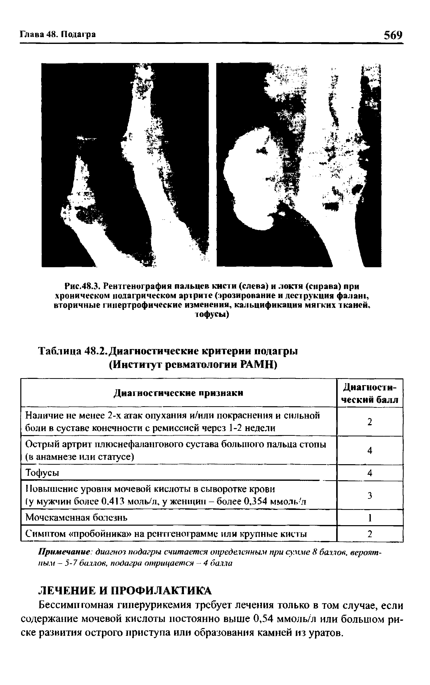 Таблица 48.2.Диагностические критерии подагры (Институт ревматологии РАМН)...