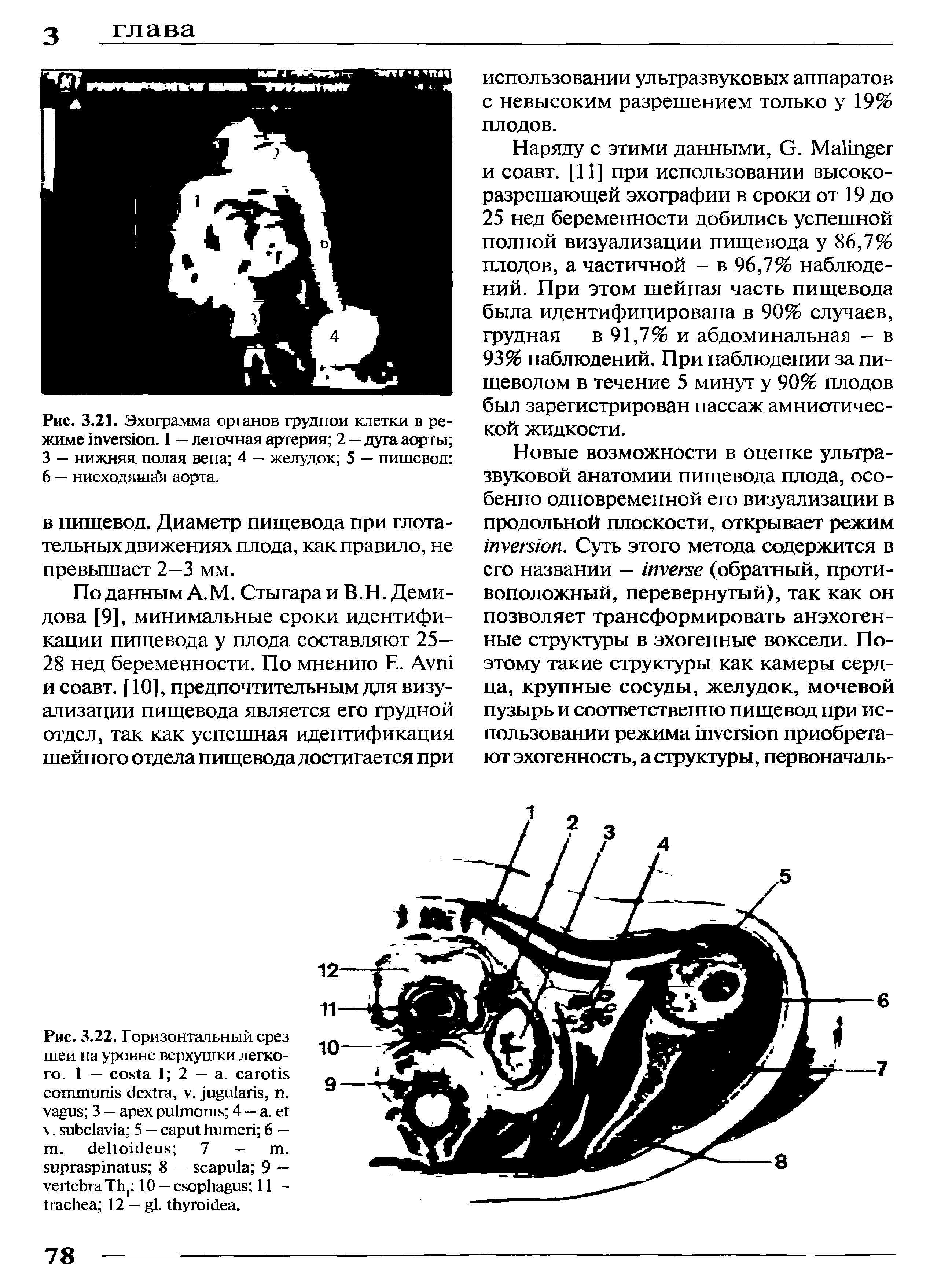 Рис. 3.22. Горизонтальный срез шеи на уровне верхушки легкого. 1 — I 2 — а. , . , . 3 — 4 — . . 5 — 6 — . 7 - .