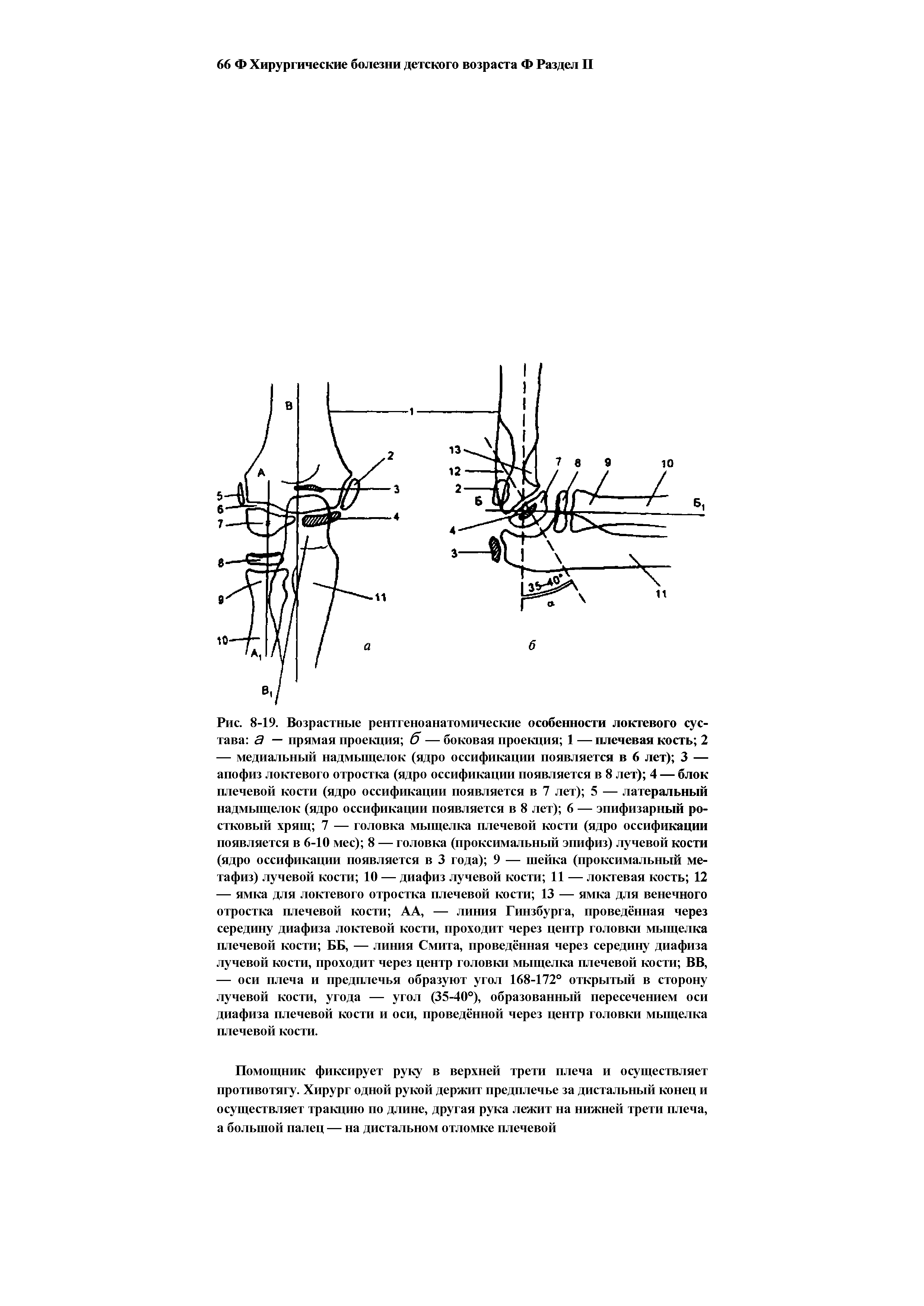 Рис. 8-19. Возрастные рентгеноанатомические особенности локтевого сустава а — прямая проекция б — боковая проекция 1 — плечевая кость 2...