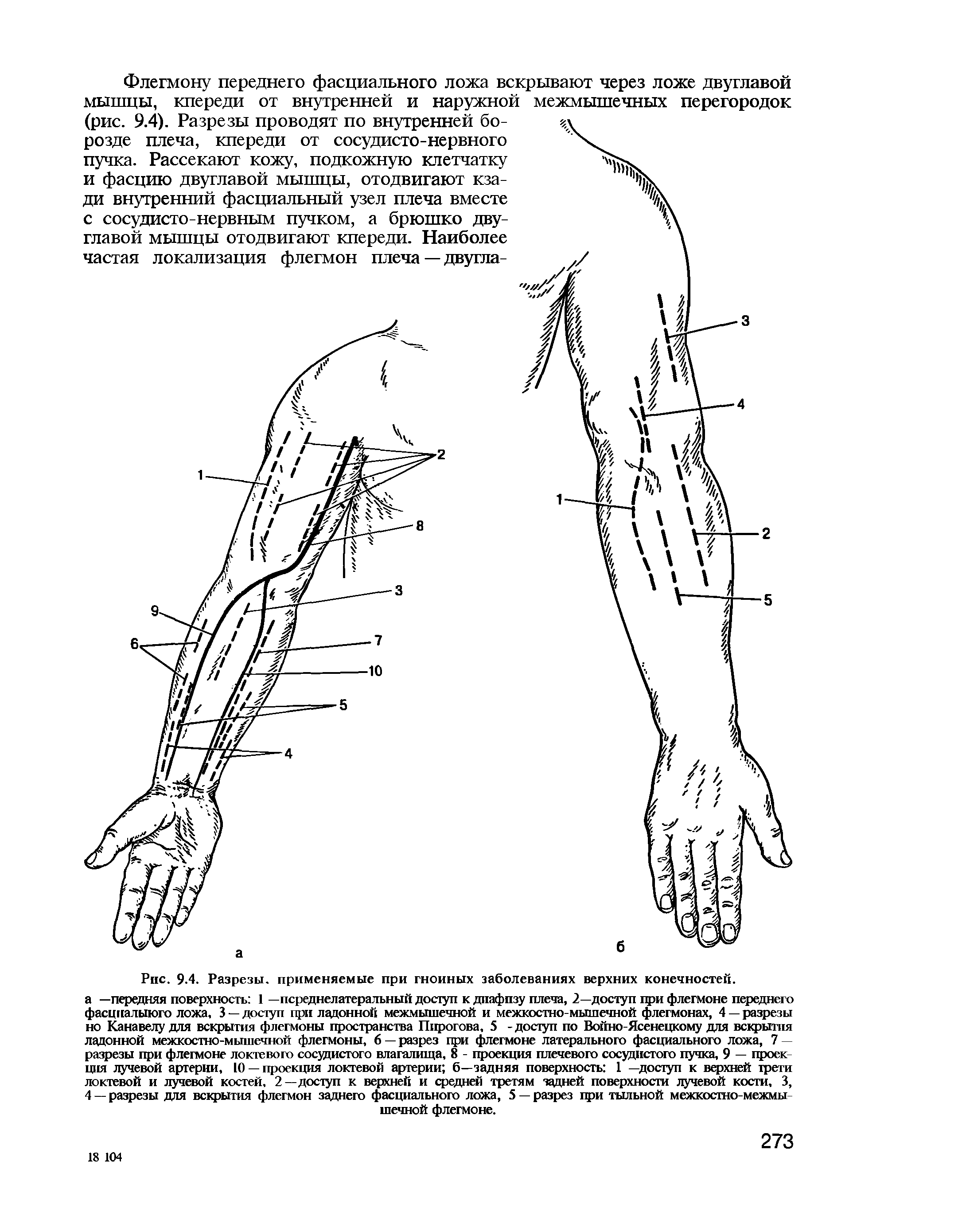 Рис. 9.4. Разрезы, применяемые при гнойных заболеваниях верхних конечностей.