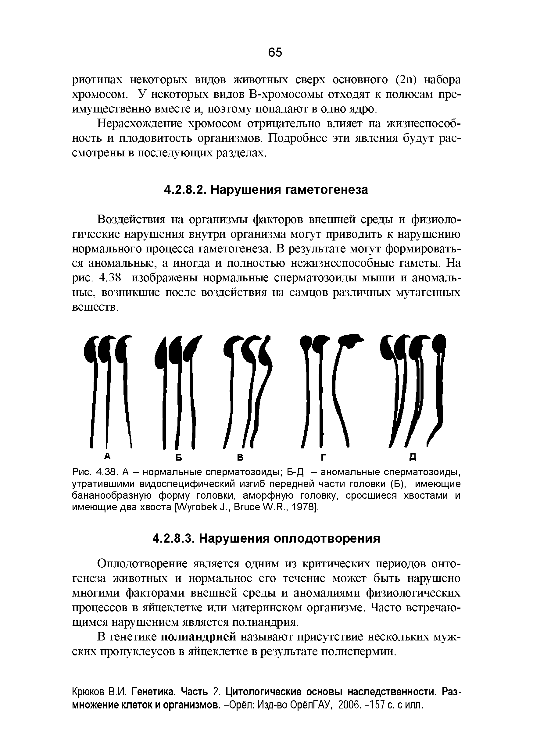 Рис. 4.38. А - нормальные сперматозоиды Б-Д - аномальные сперматозоиды, утратившими видоспецифический изгиб передней части головки (Б), имеющие бананообразную форму головки, аморфную головку, сросшиеся хвостами и имеющие два хвоста [W J., B W.R., 1978].