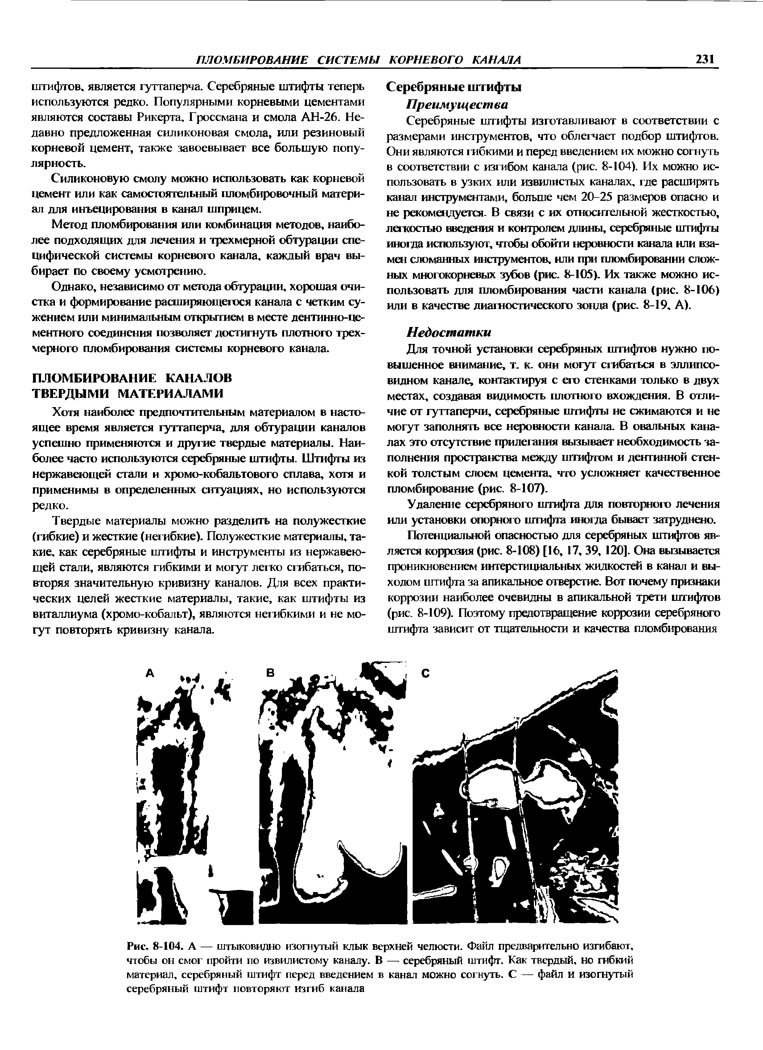 Рис. 8-104. А — штыковидно изогнутый клык верхней челюсти. Файл предварительно изгибают, чтобы он смог пройти по извилистому каналу. В — серебряный штифт. Как твердый, но гибкий материал, серебряный штифт перед введением в канал можно согнуть. С — файл и изогнутый серебряный штифт повторяют изгиб канала...